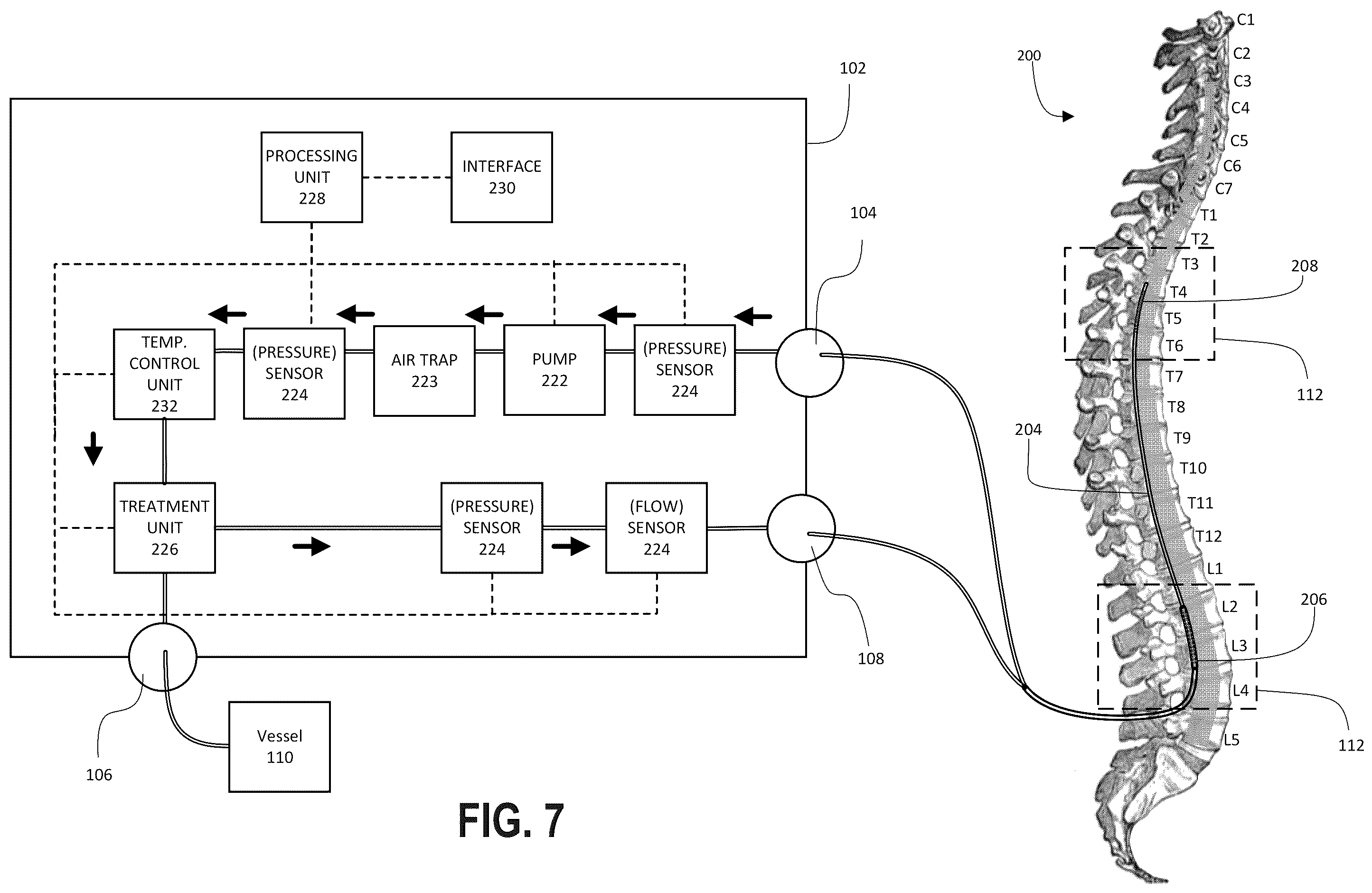 Patent US12576251 Figure 5 – Systems and methods for the conditioning of cerebrospinal fluid