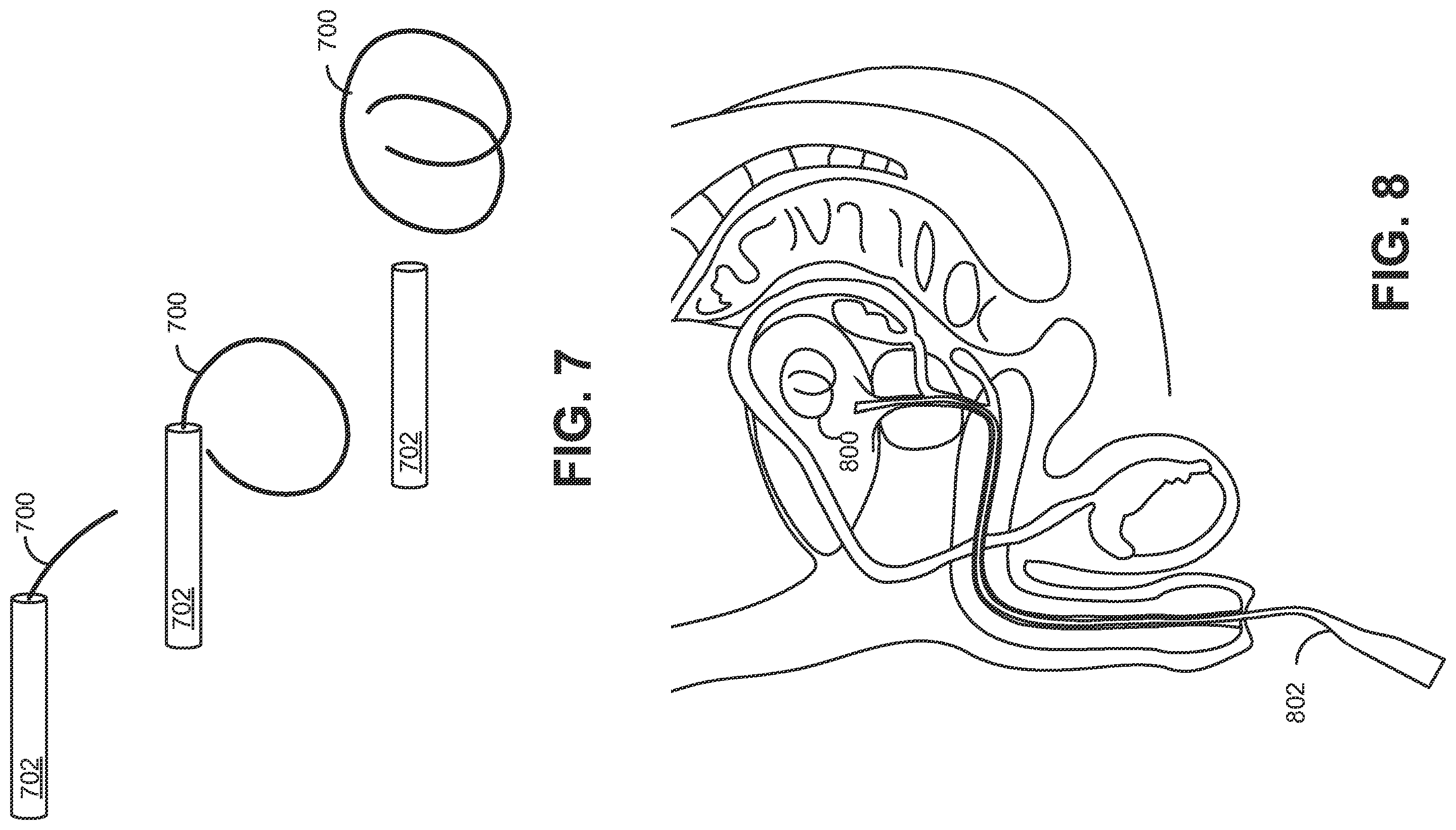 Patent US12576253 Figure 3 – Drug delivery device with intravesical tolerability