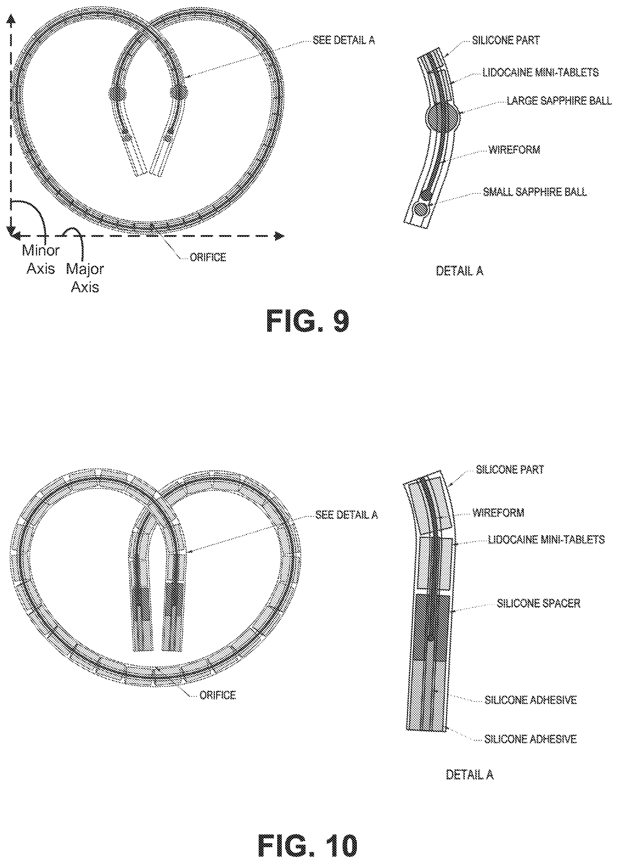 Patent US12576253 Figure 4 – Drug delivery device with intravesical tolerability