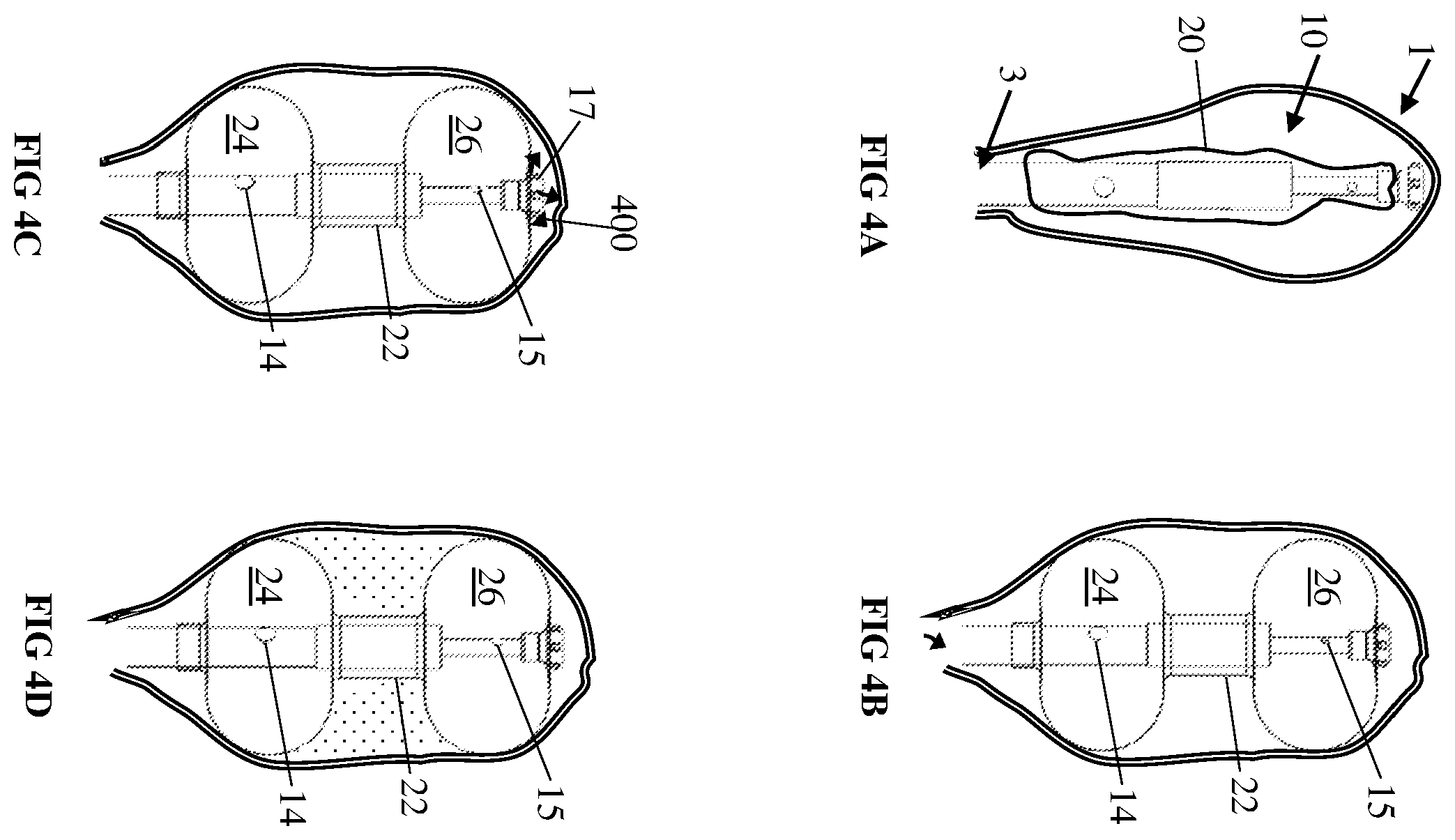 Patent US12576254 Figure 5 – System and method for ultrasonic bladder therapeutic agent delivery