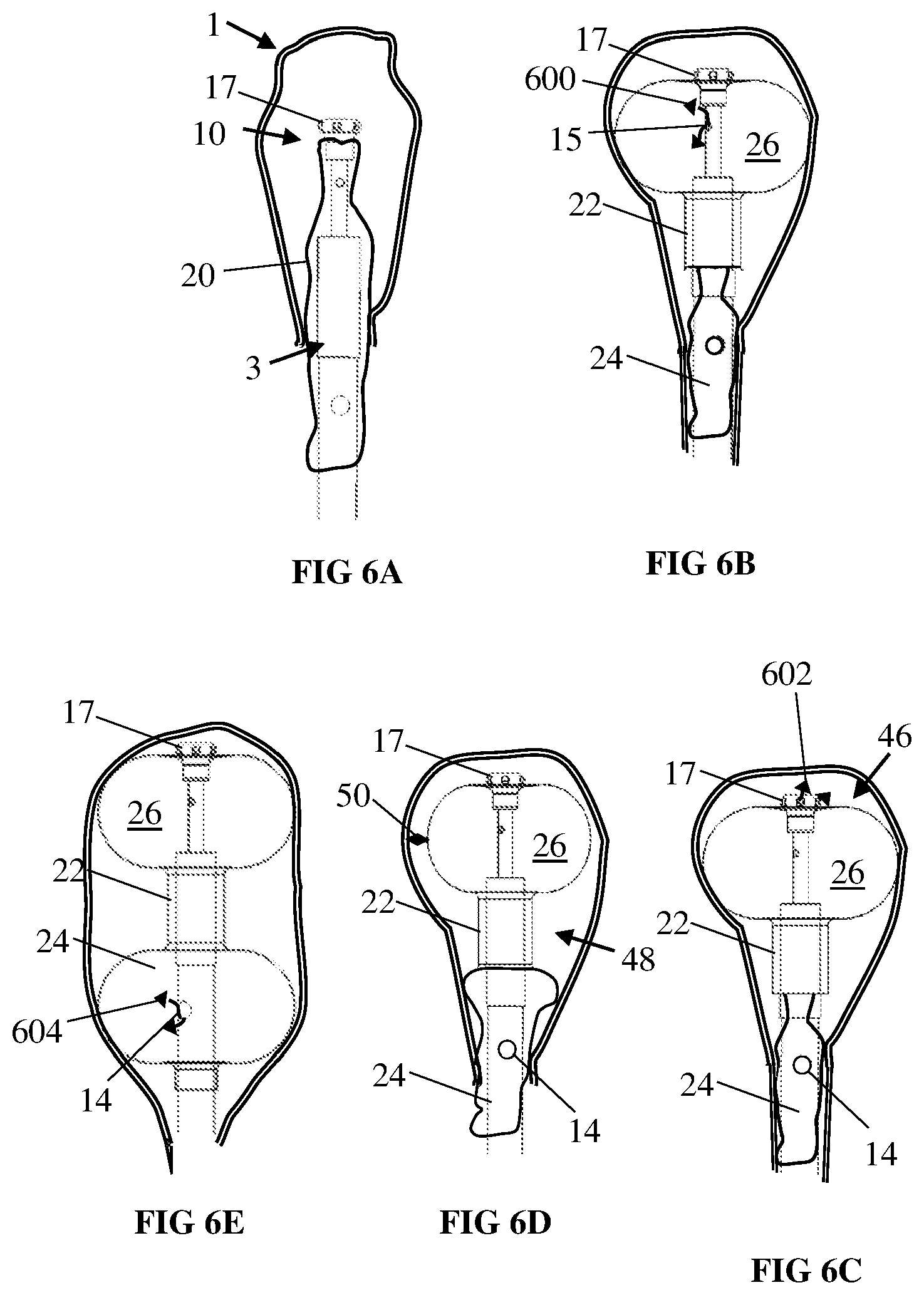 Patent US12576254 Figure 7 – System and method for ultrasonic bladder therapeutic agent delivery