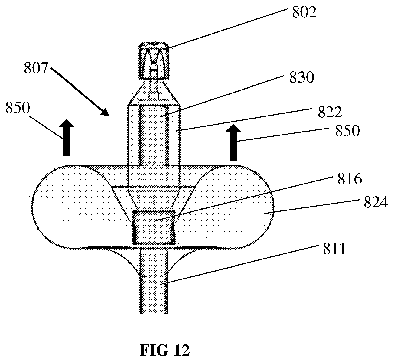 Patent US12576254 Figure 14 – System and method for ultrasonic bladder therapeutic agent delivery