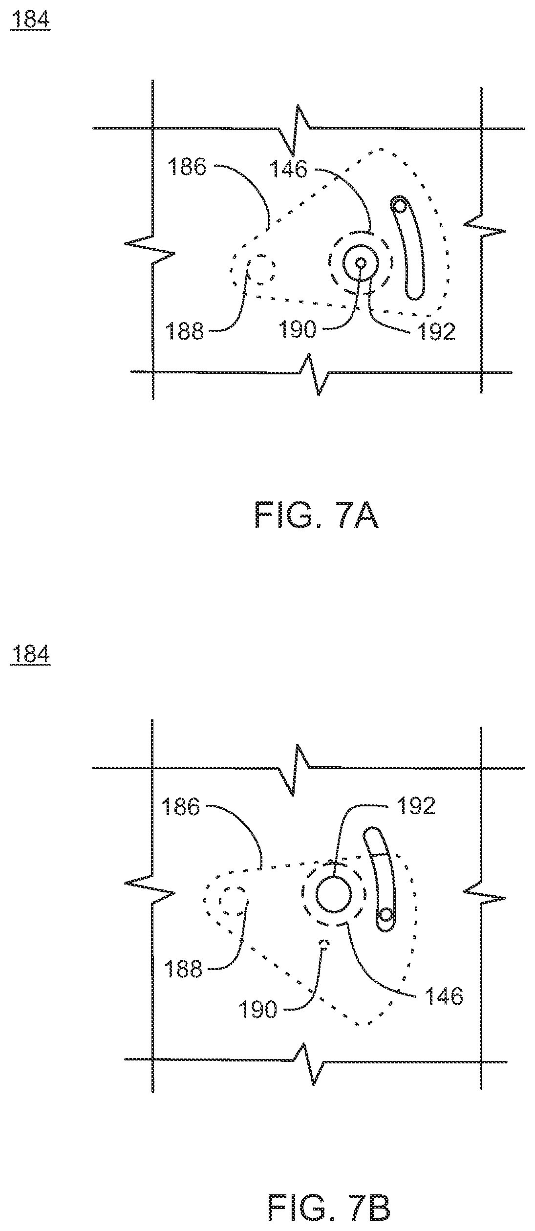 Patent US12576258 Figure 6 – Infusion pump assembly