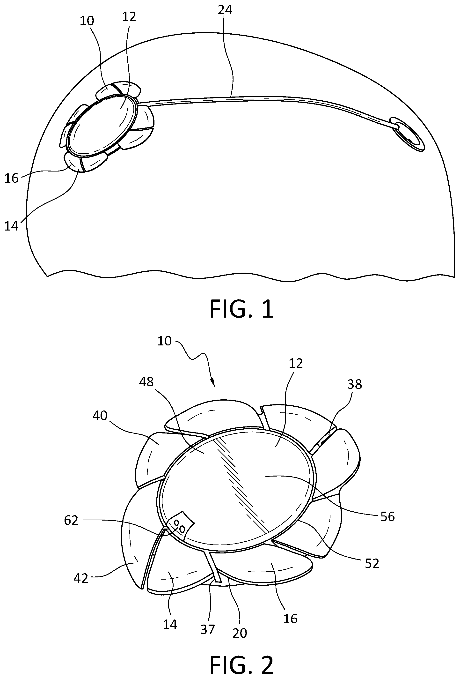 Patent US12576266 — Cranial implant with wire management structure — Figure 1
