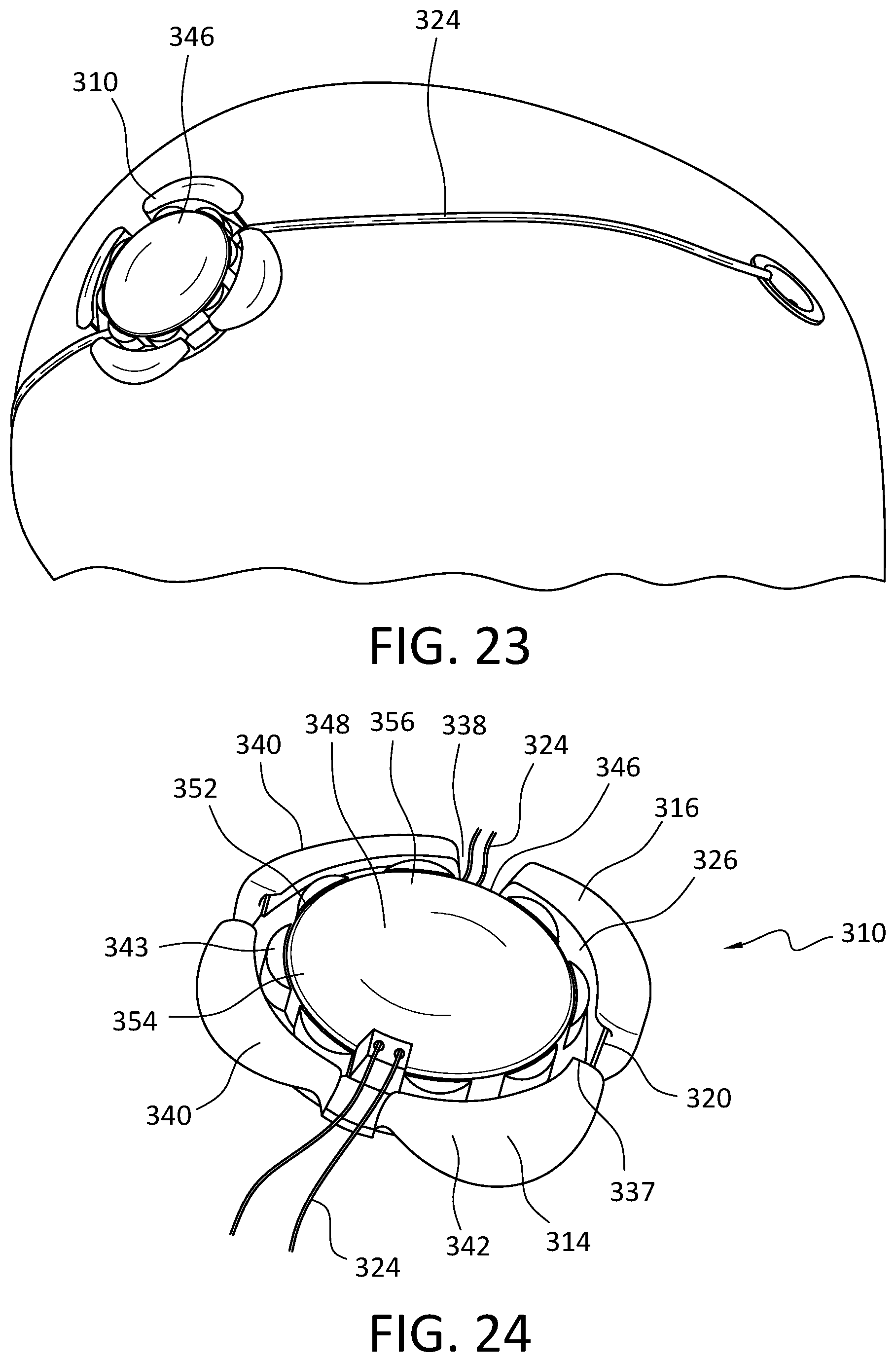 Patent US12576266 Figure 12 – Cranial implant with wire management structure