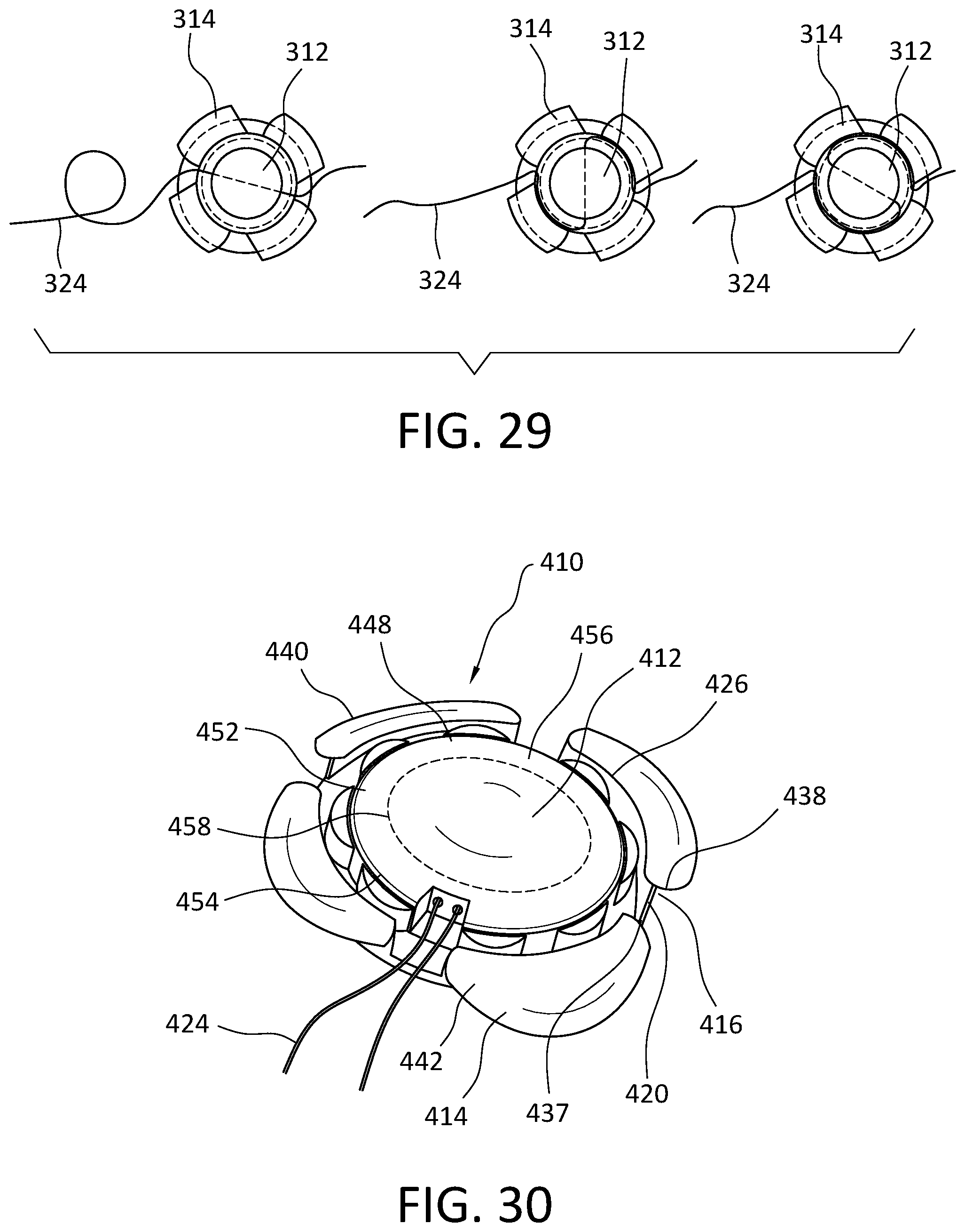 Patent US12576266 Figure 15 – Cranial implant with wire management structure