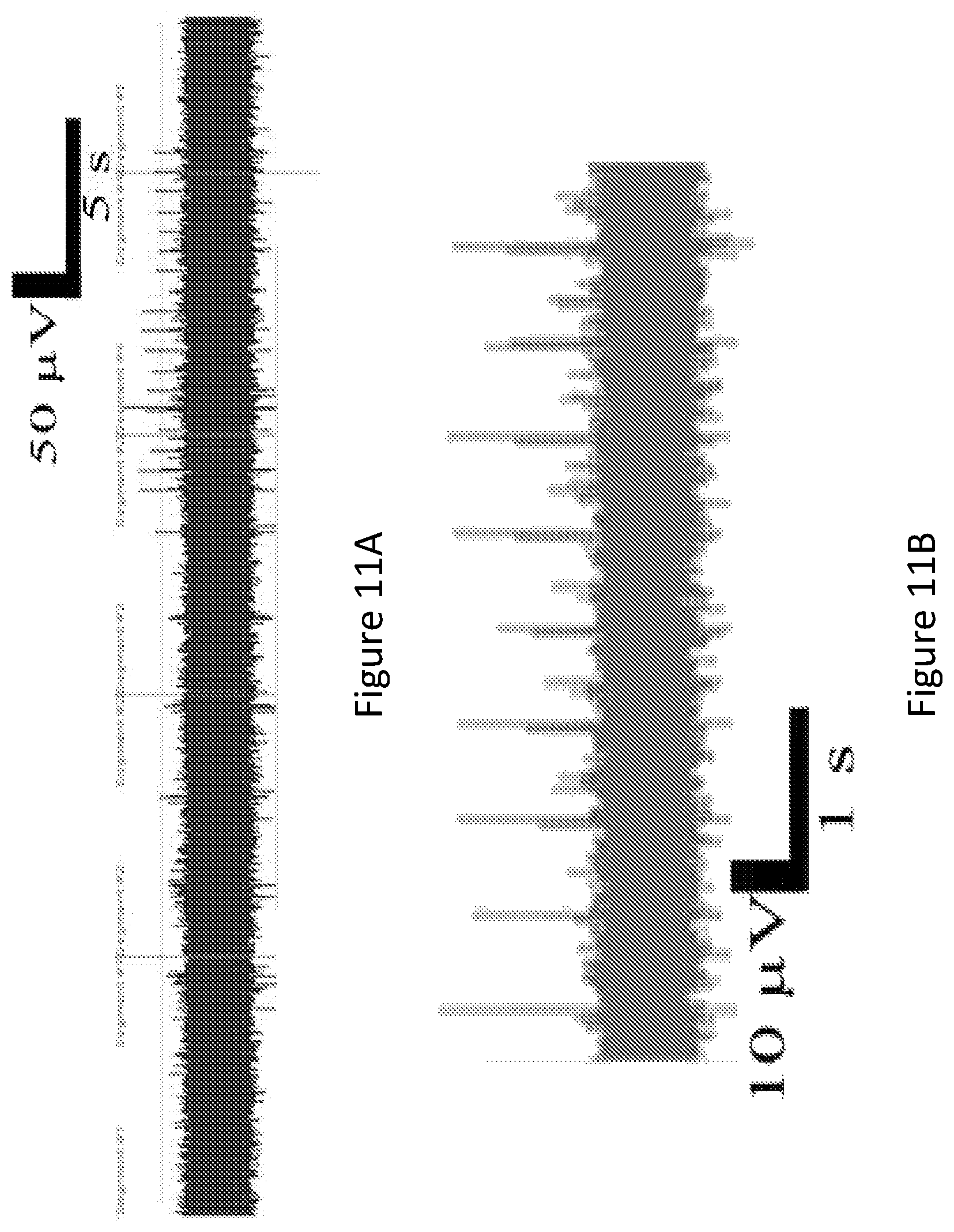 Patent US12576268 Figure 12 – Conformable neural interface device with hydrogel adhesion and methods of using the same