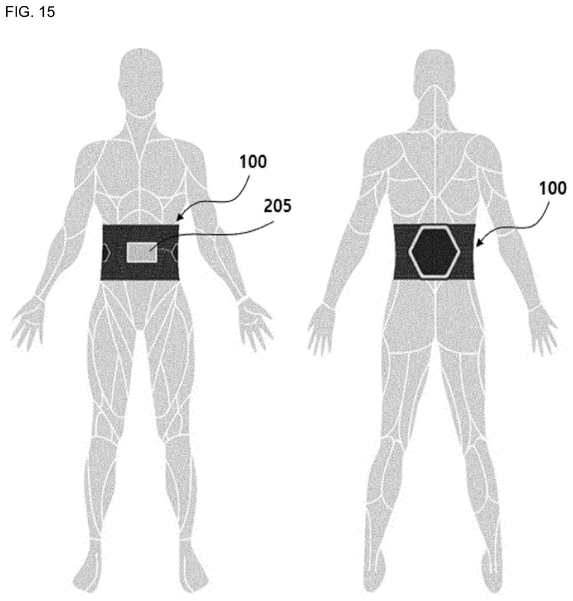 Patent US12576269 Figure 11 – Electronic device using low frequency and method of operation thereof