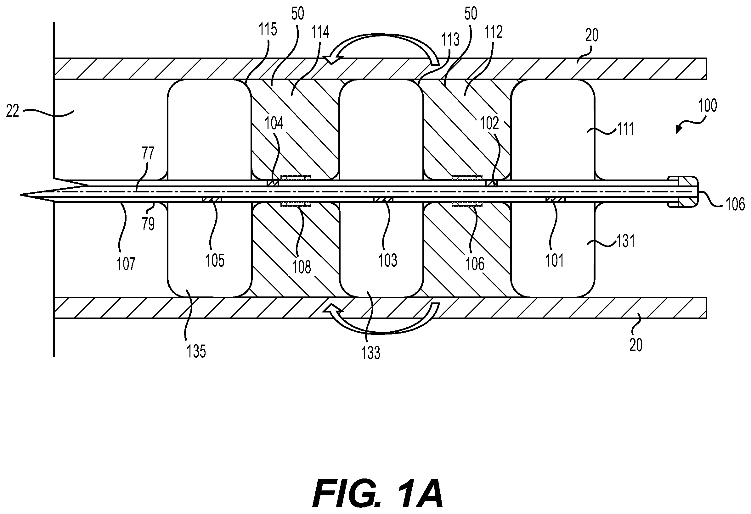 Patent US12576270 Figure 1 – Medical devices for electroporation
