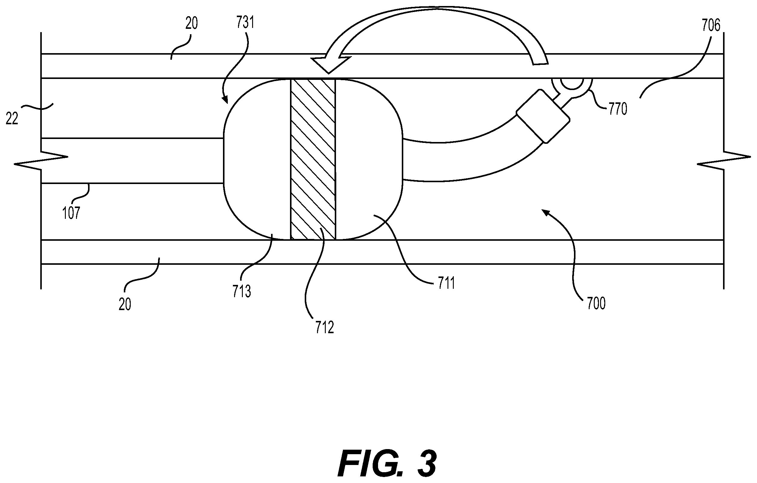 Patent US12576270 Figure 7 – Medical devices for electroporation