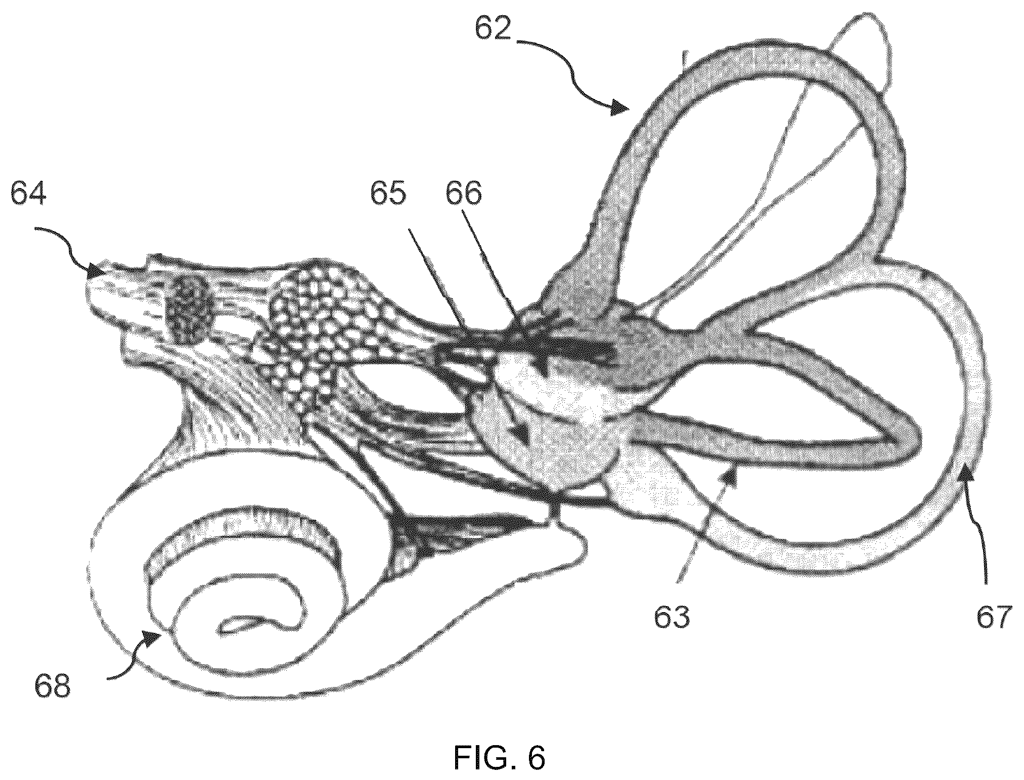 Patent US12576271 Figure 5 – Systems, devices and methods for anxiety treatment using vestibular nerve stimulation