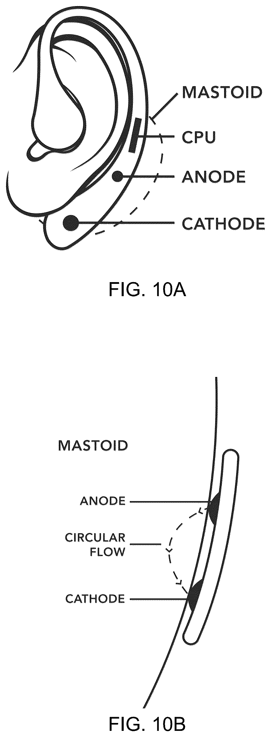 Patent US12576271 Figure 9 – Systems, devices and methods for anxiety treatment using vestibular nerve stimulation