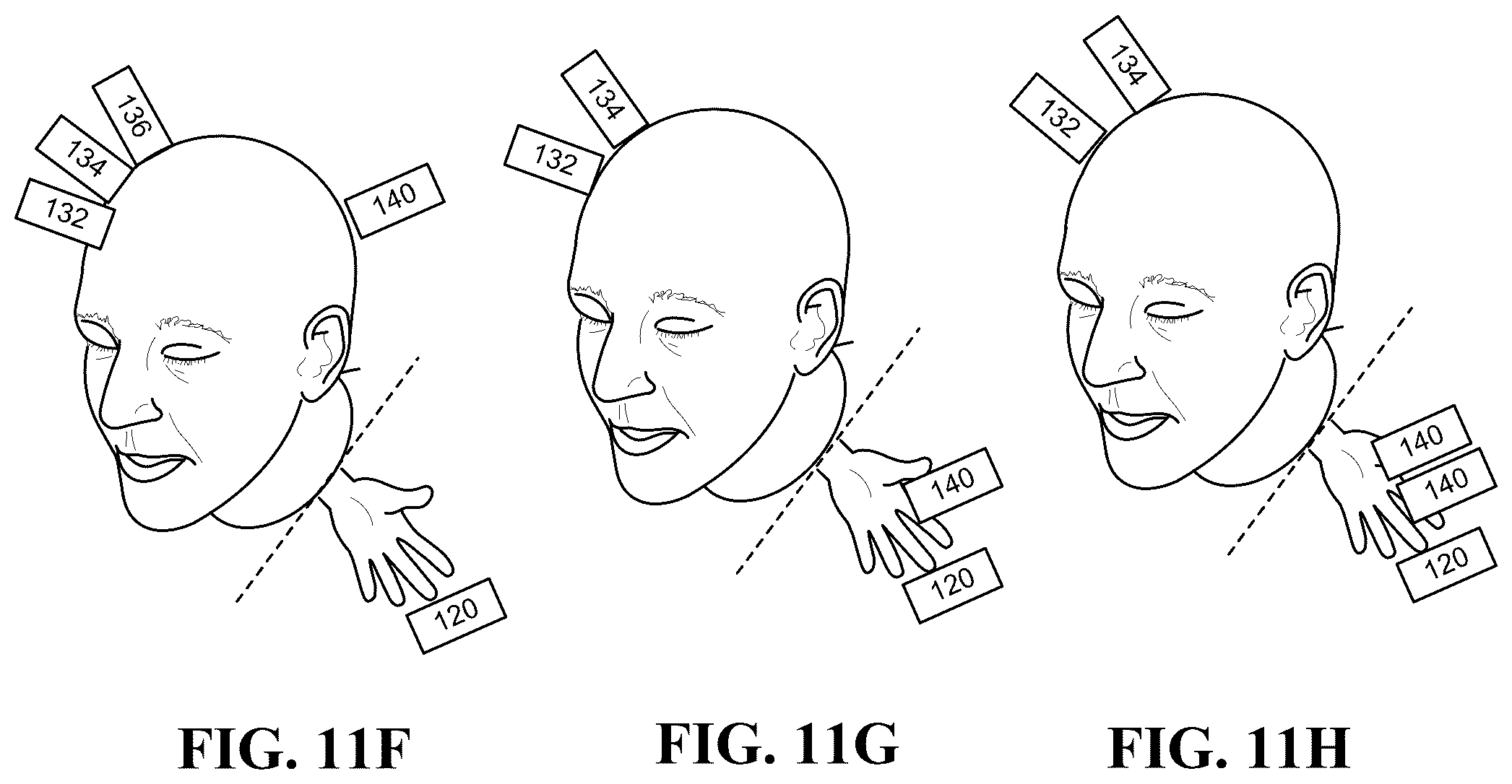 Patent US12576272 Figure 17 – Engagement component selection for control of bio-psychiatric therapeutic trajectory (BTT)