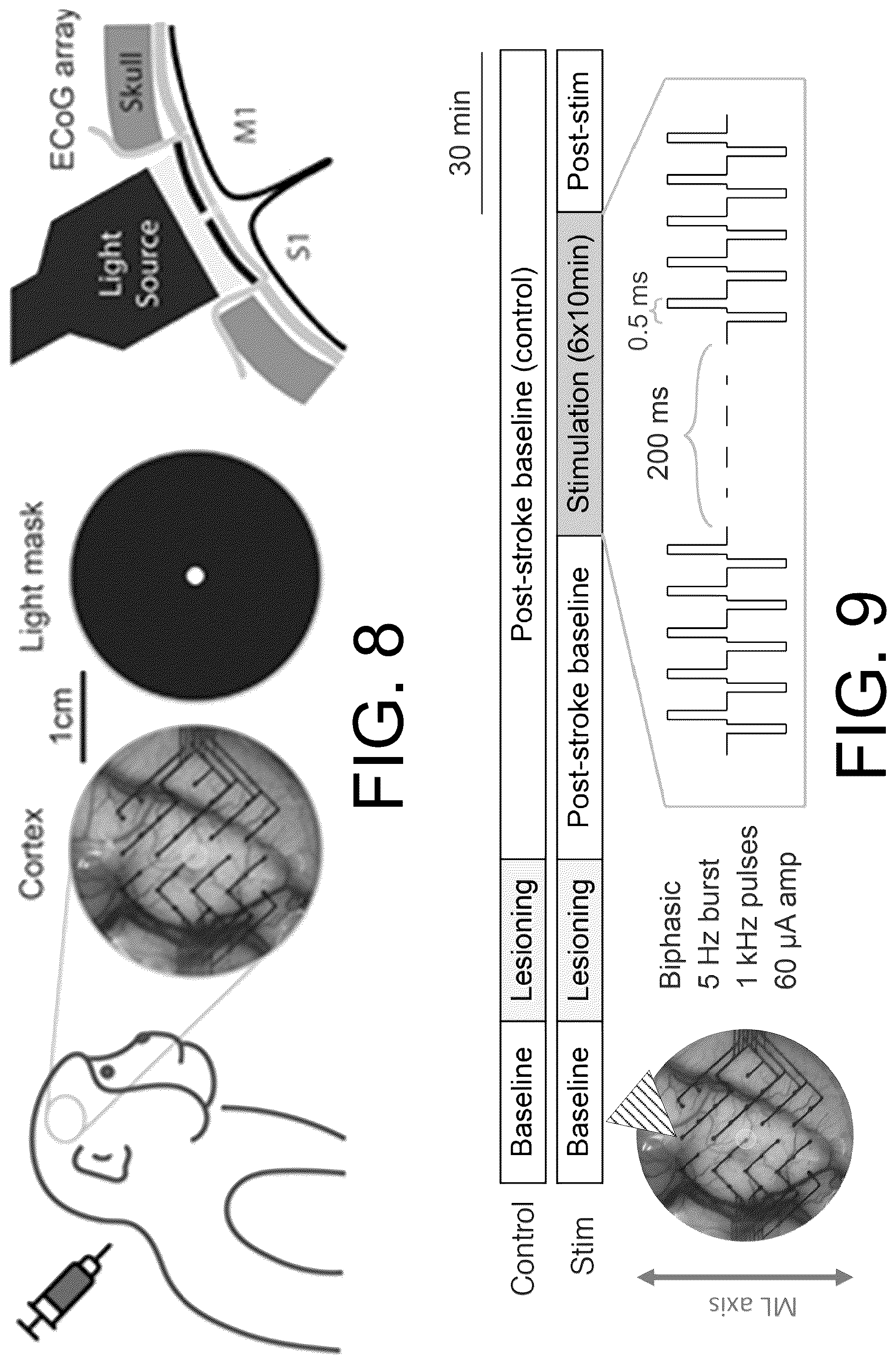 Patent US12576274 Figure 6 – Treating stroke using electrical stimulation