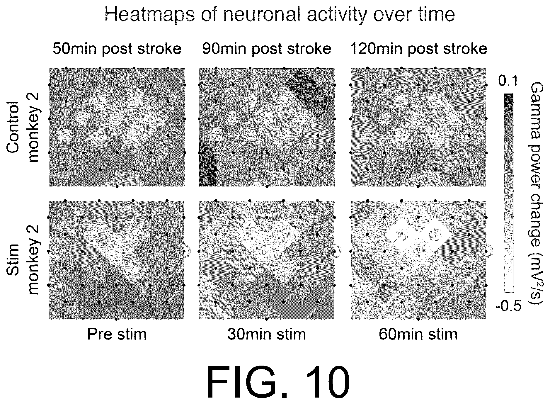 Patent US12576274 Figure 7 – Treating stroke using electrical stimulation