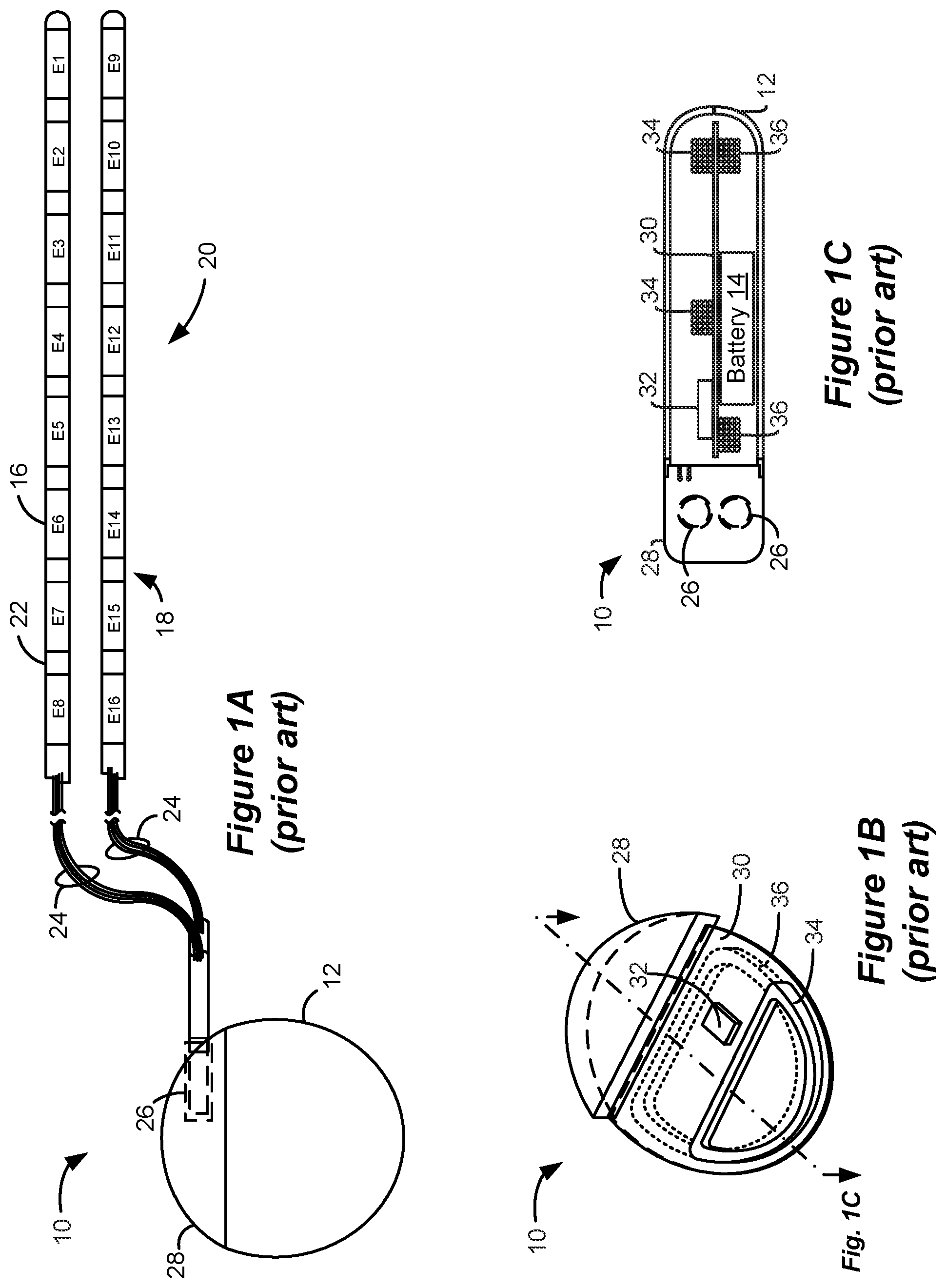 Patent US12576276 Figure 1 – Amplitude modulating waveform pattern generation for stimulation in an implantable pulse generator