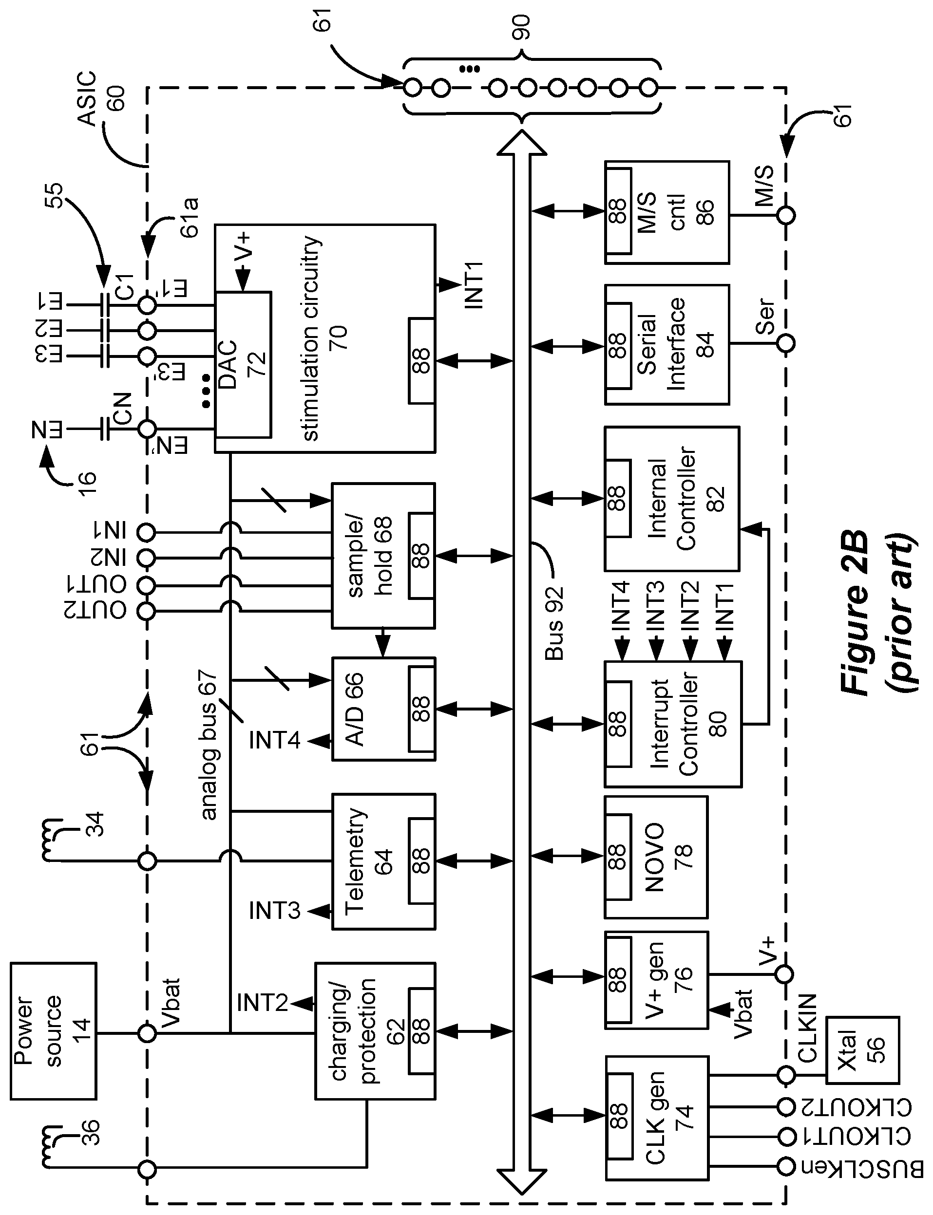 Patent US12576276 Figure 3 – Amplitude modulating waveform pattern generation for stimulation in an implantable pulse generator