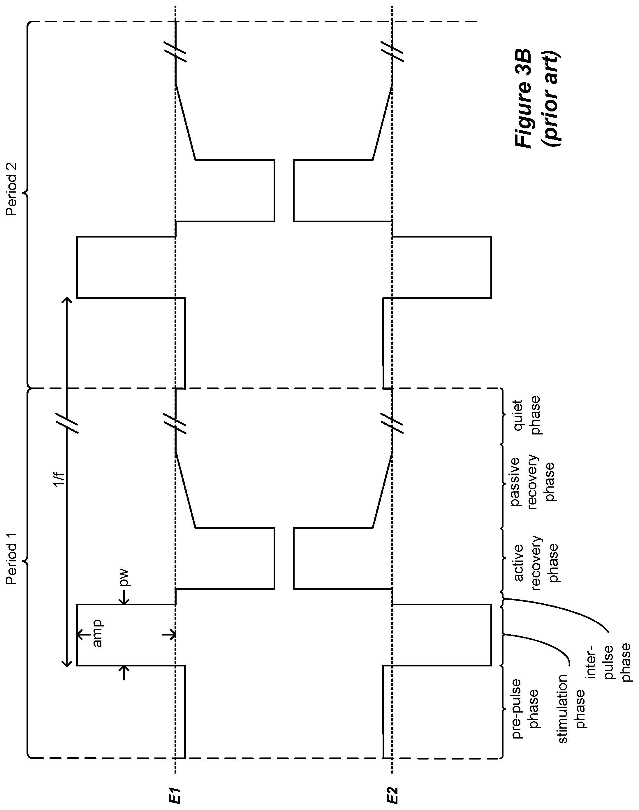 Patent US12576276 Figure 5 – Amplitude modulating waveform pattern generation for stimulation in an implantable pulse generator