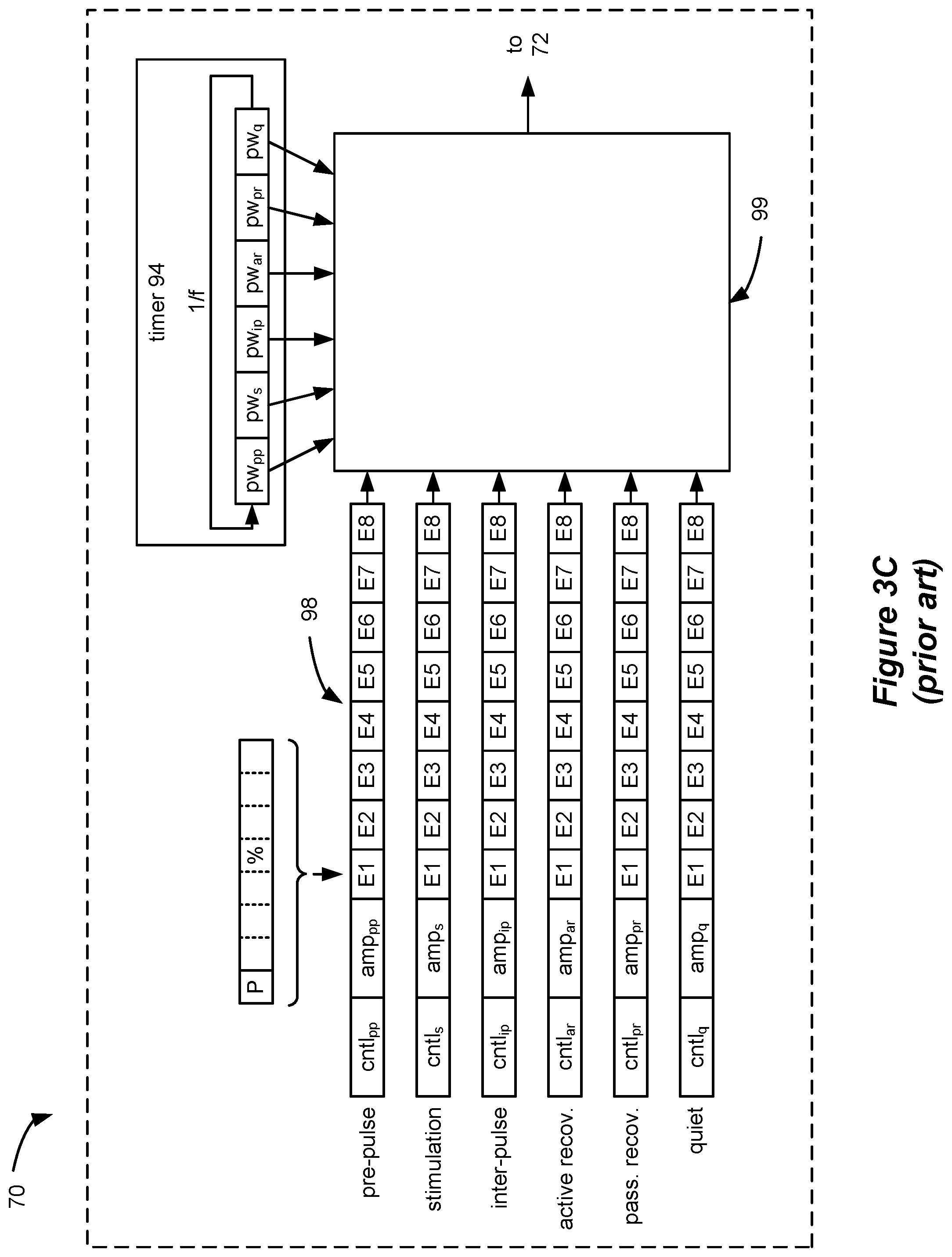 Patent US12576276 Figure 6 – Amplitude modulating waveform pattern generation for stimulation in an implantable pulse generator