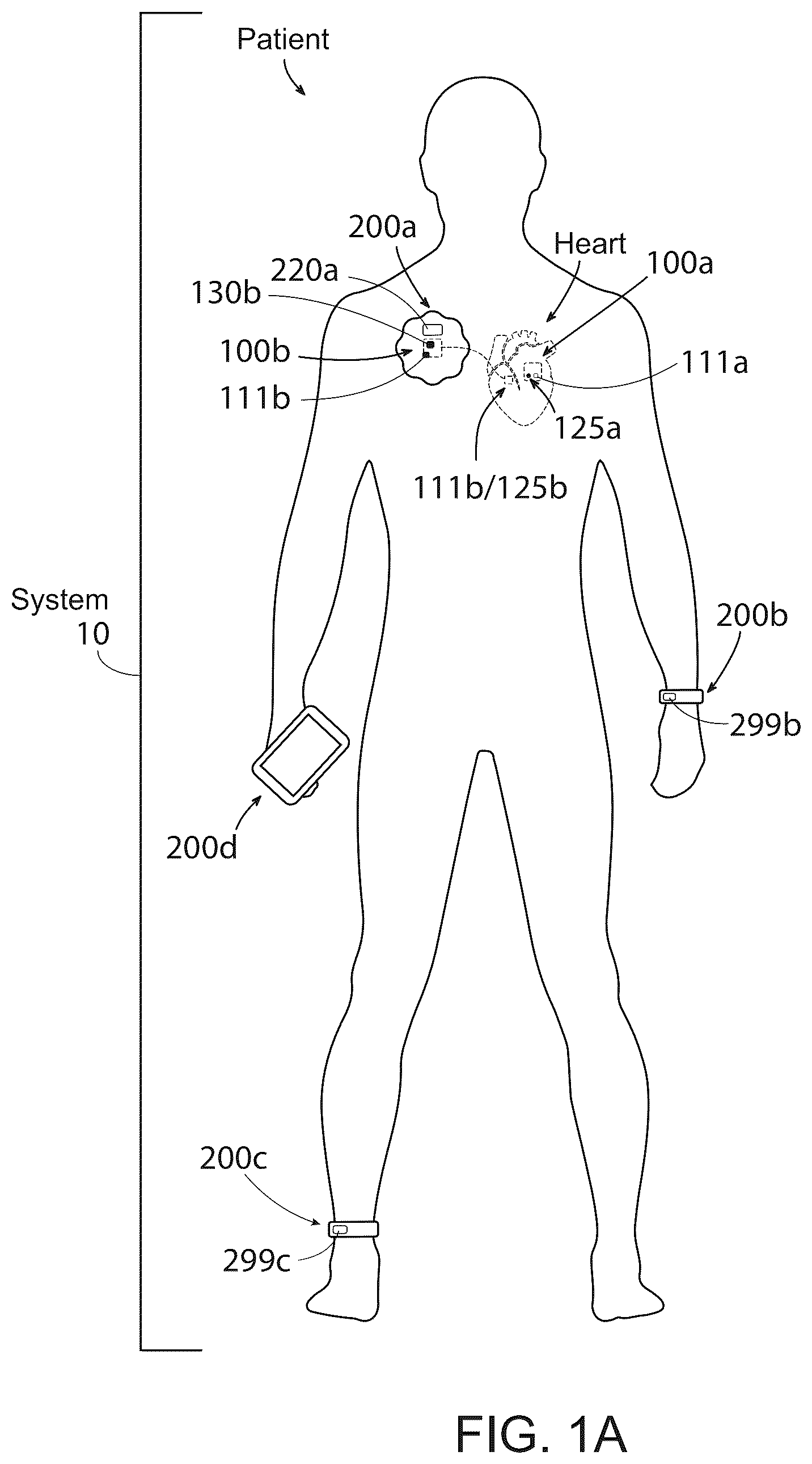 Patent US12576277 Figure 2 – Advanced pacing