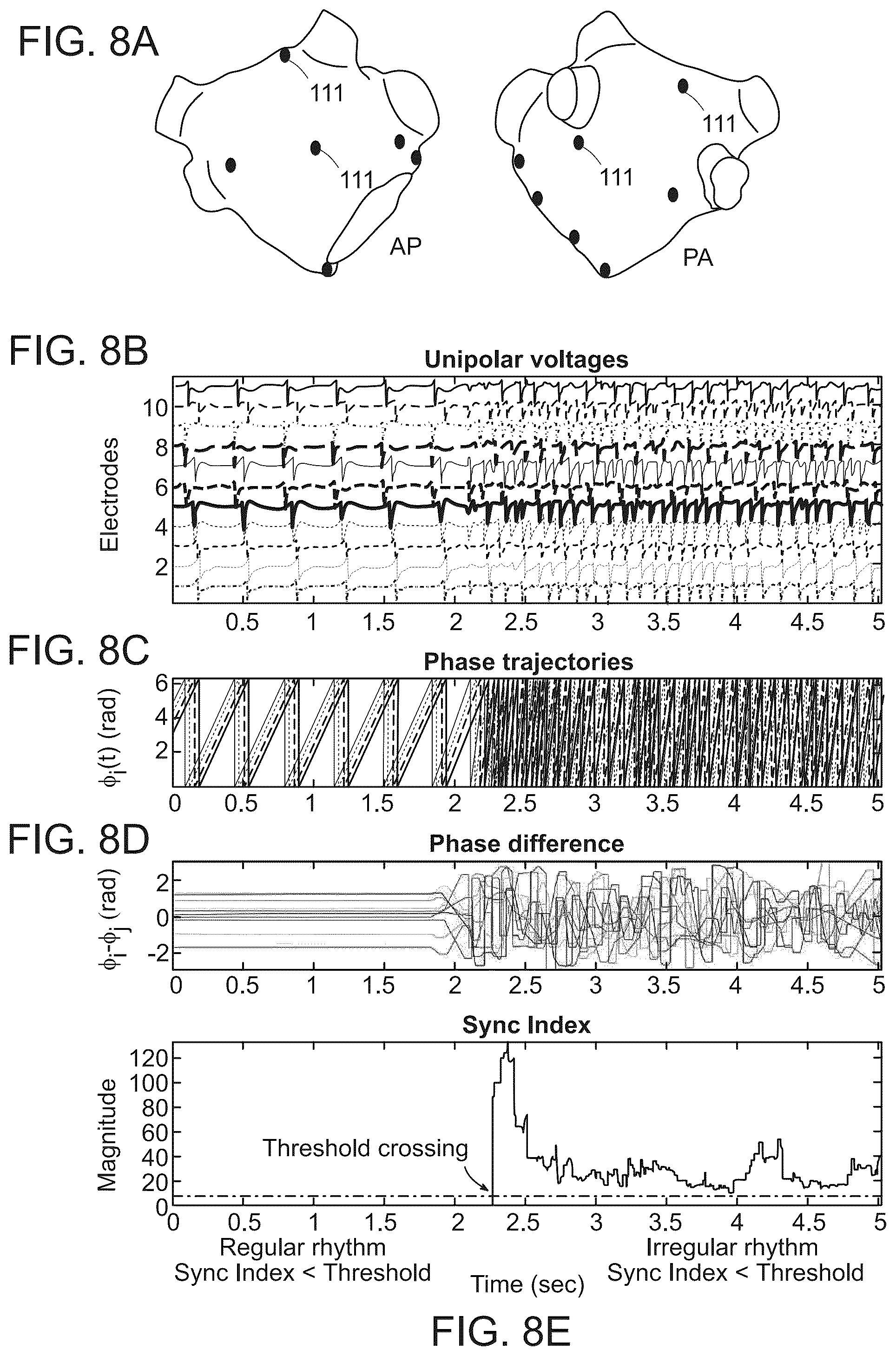 Patent US12576277 Figure 13 – Advanced pacing