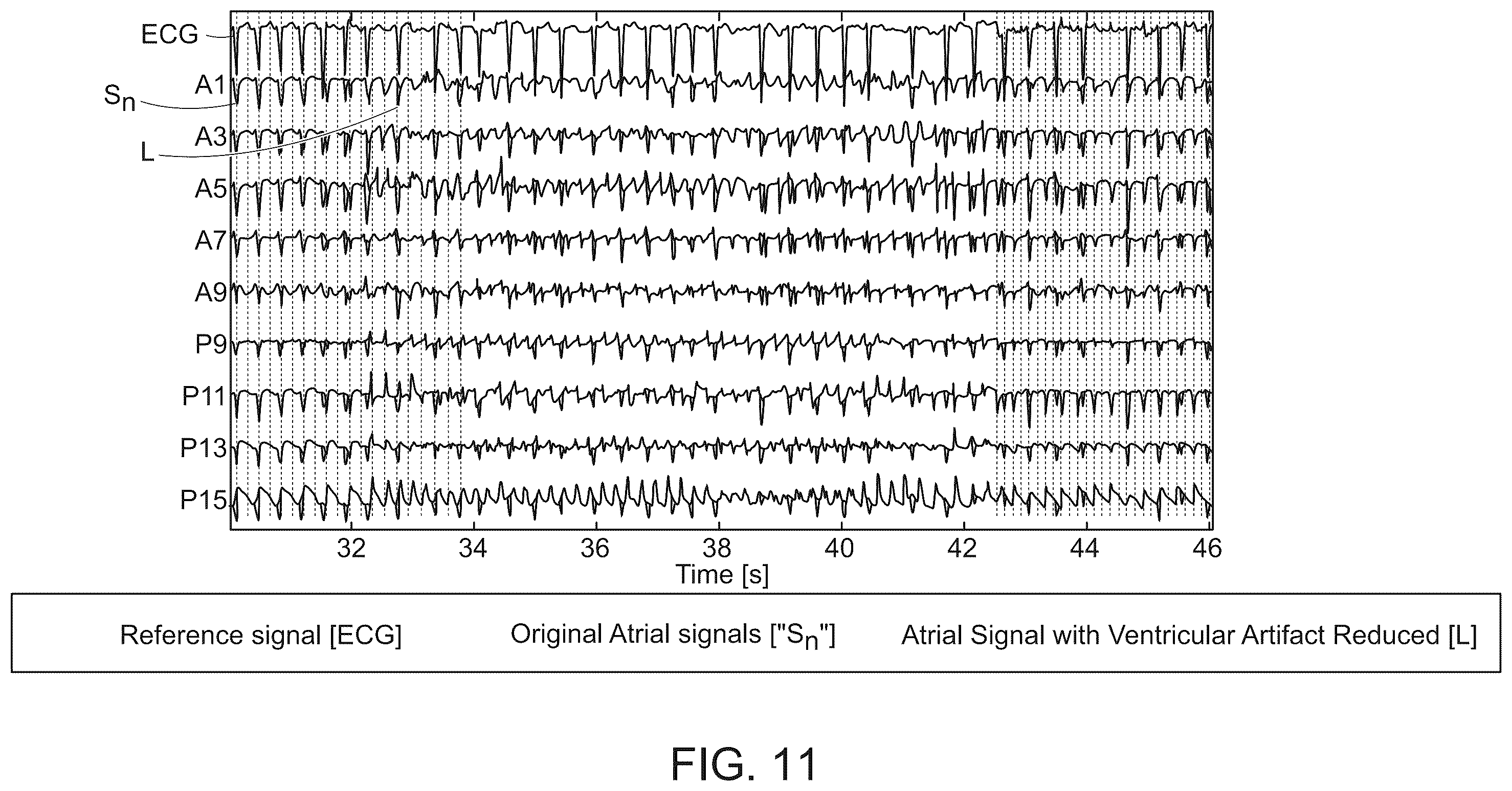 Patent US12576277 Figure 16 – Advanced pacing
