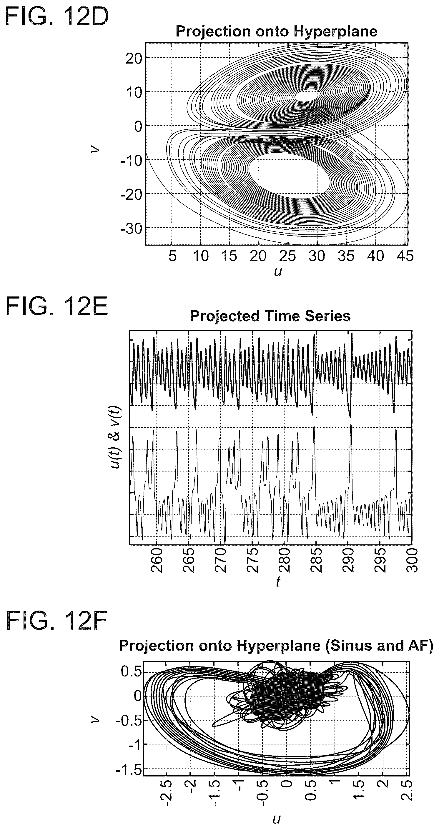 Patent US12576277 Figure 18 – Advanced pacing