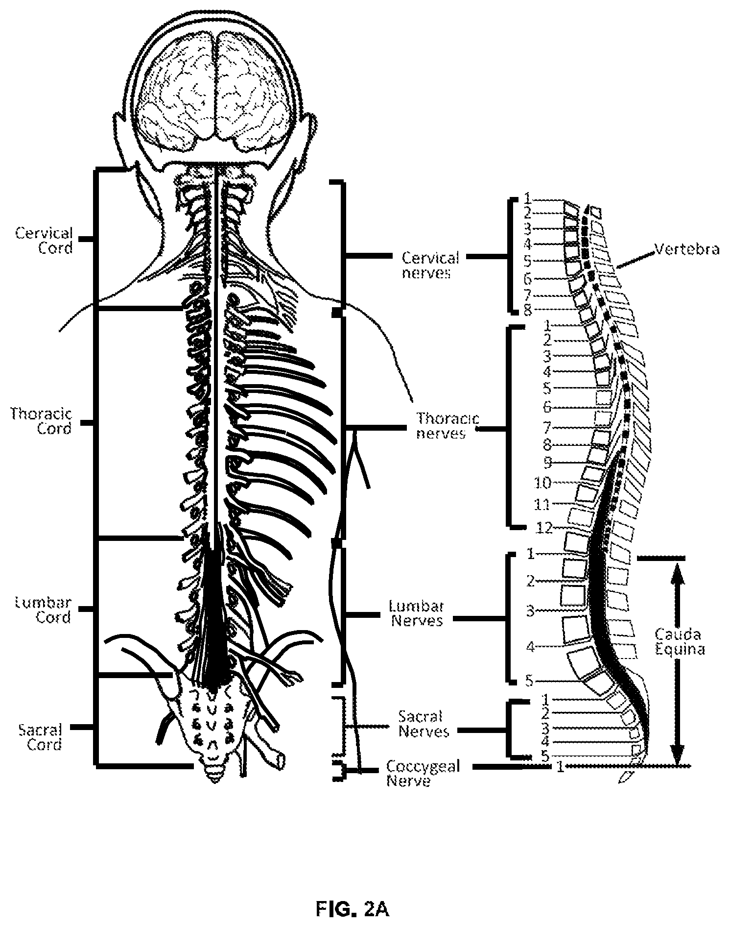 Patent US12576279 Figure 2 – Header for a neurostimulator
