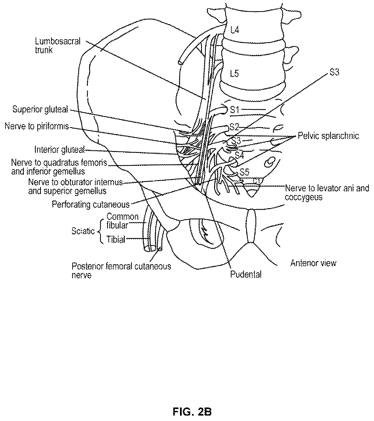 Patent US12576279 Figure 3 – Header for a neurostimulator