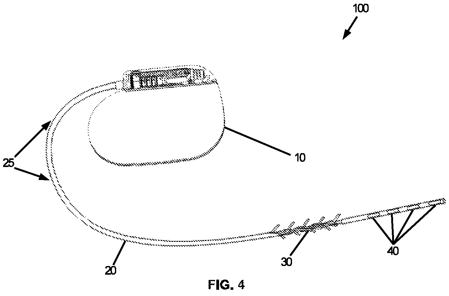 Patent US12576279 Figure 6 – Header for a neurostimulator