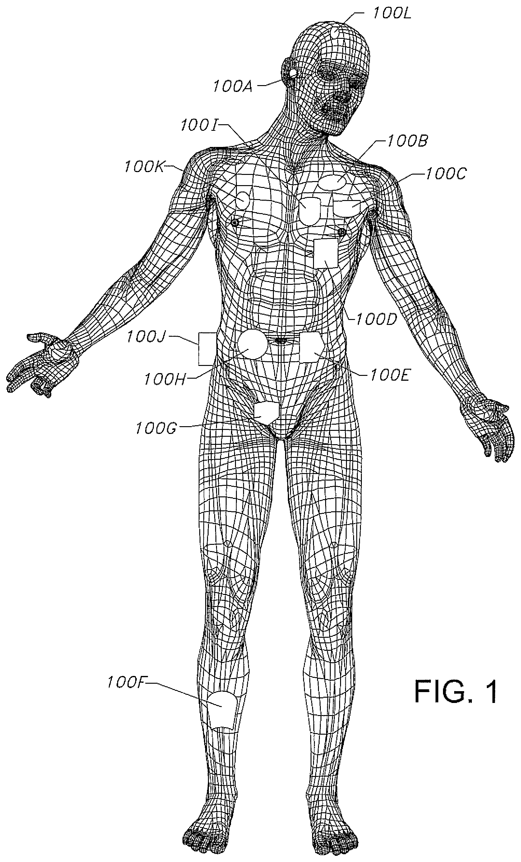 Patent US12576280 Figure 1 – Active medical device having a terminal housing assembly connected to a printed circuit board assembly without an intermediate feedthrough