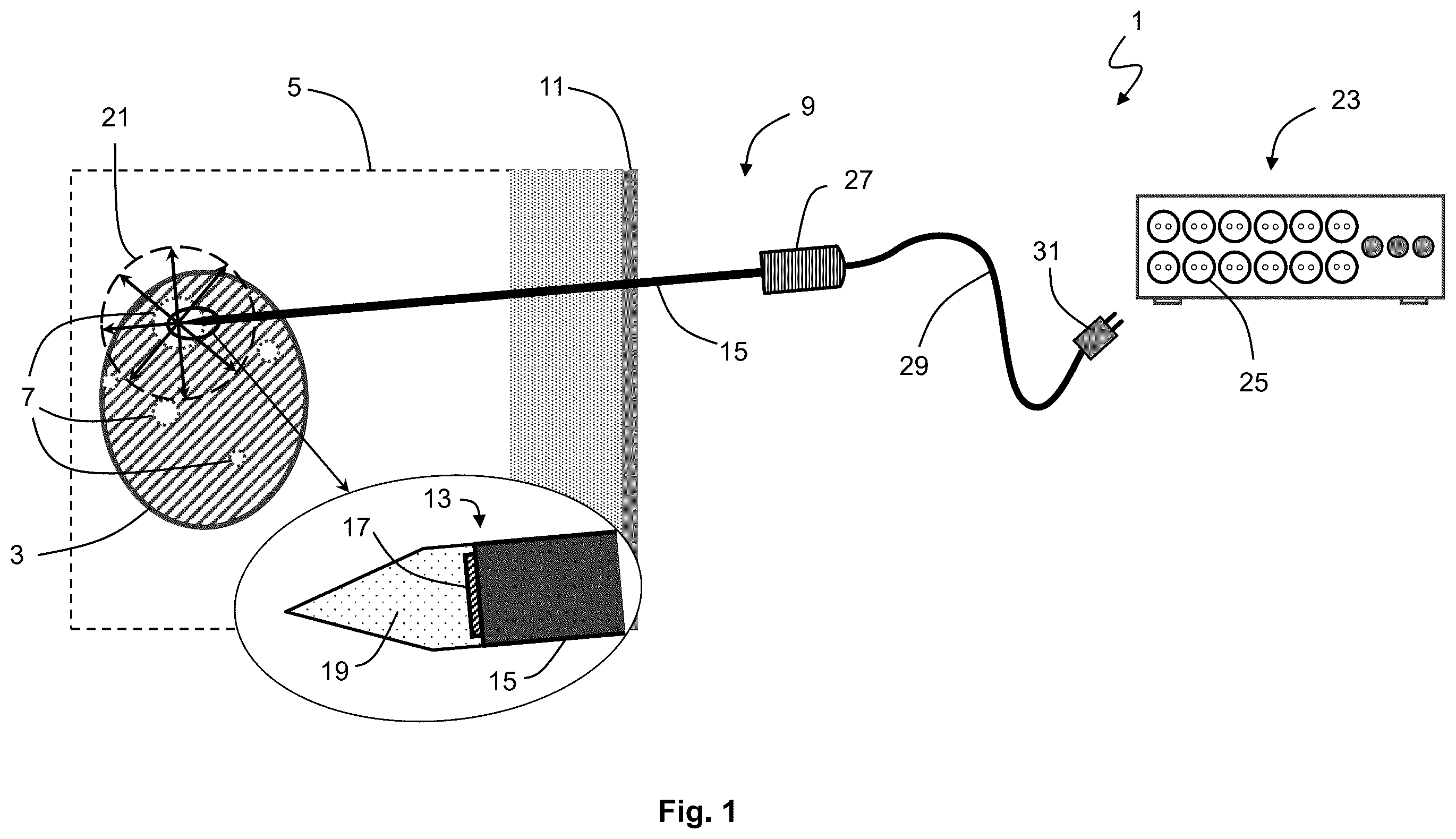 Patent US12576283 Figure 1 – System for performing transcutaneous photodynamic therapy (PDT) in an organ or organ segment of an organic body