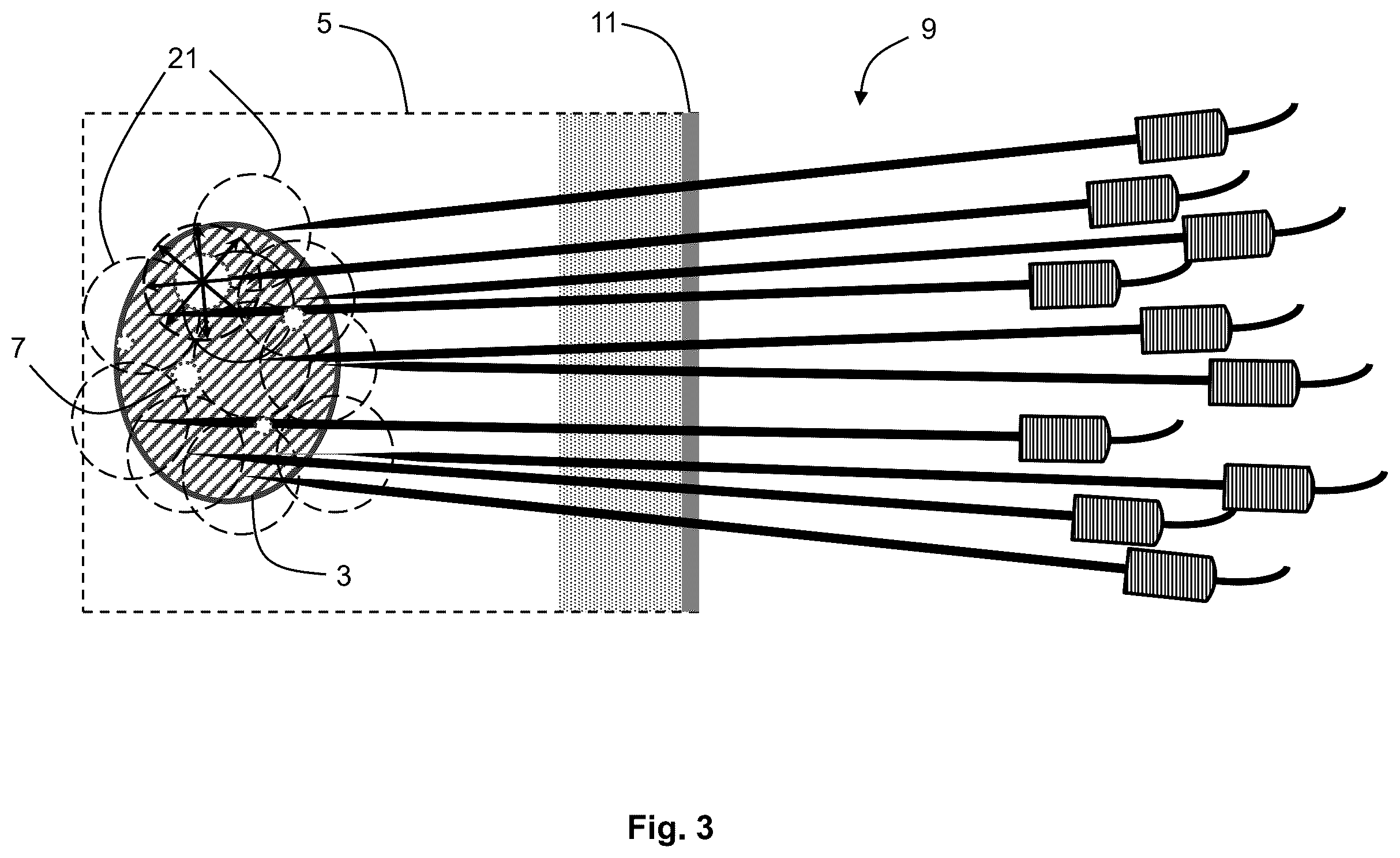 Patent US12576283 Figure 3 – System for performing transcutaneous photodynamic therapy (PDT) in an organ or organ segment of an organic body