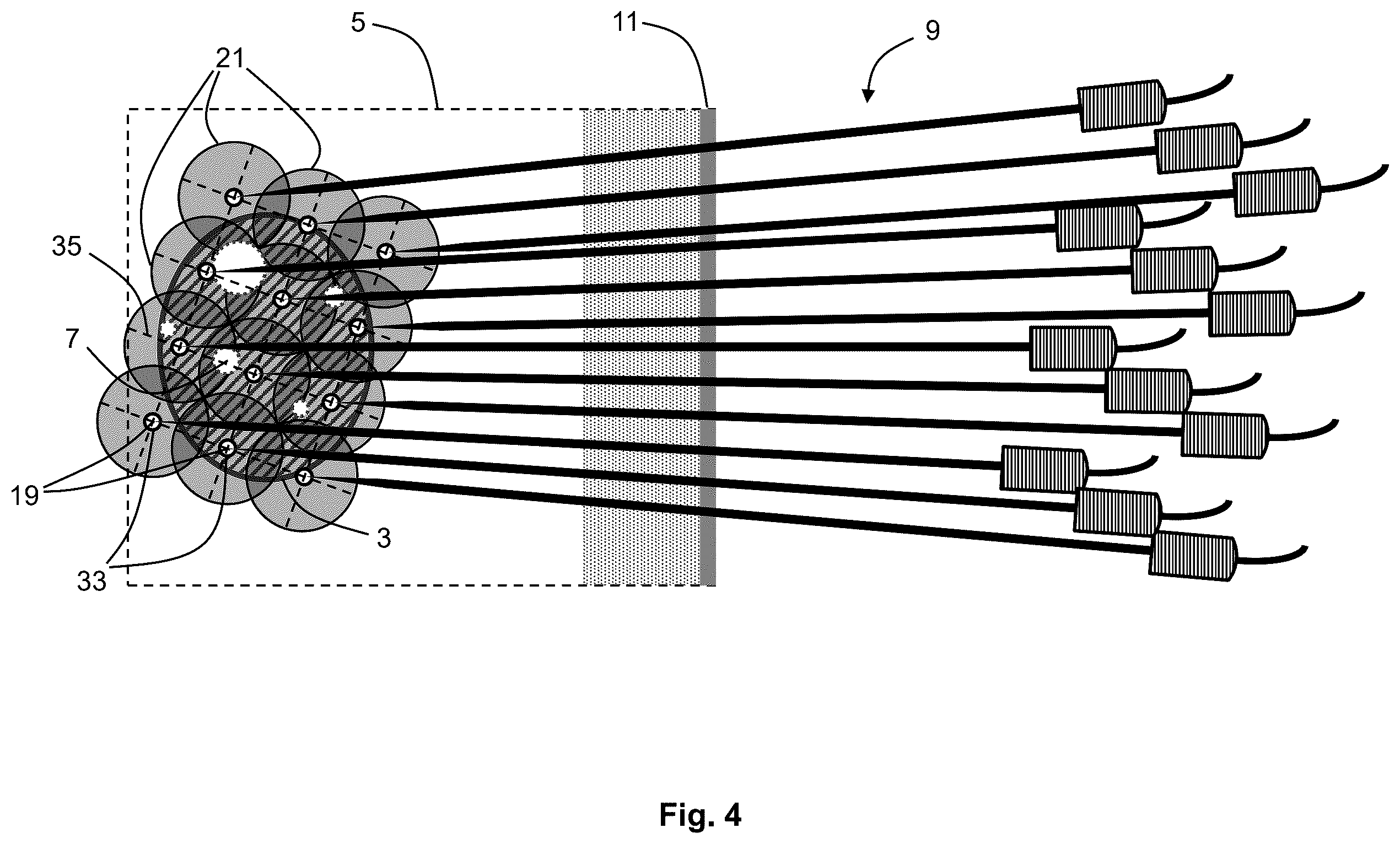 Patent US12576283 Figure 4 – System for performing transcutaneous photodynamic therapy (PDT) in an organ or organ segment of an organic body