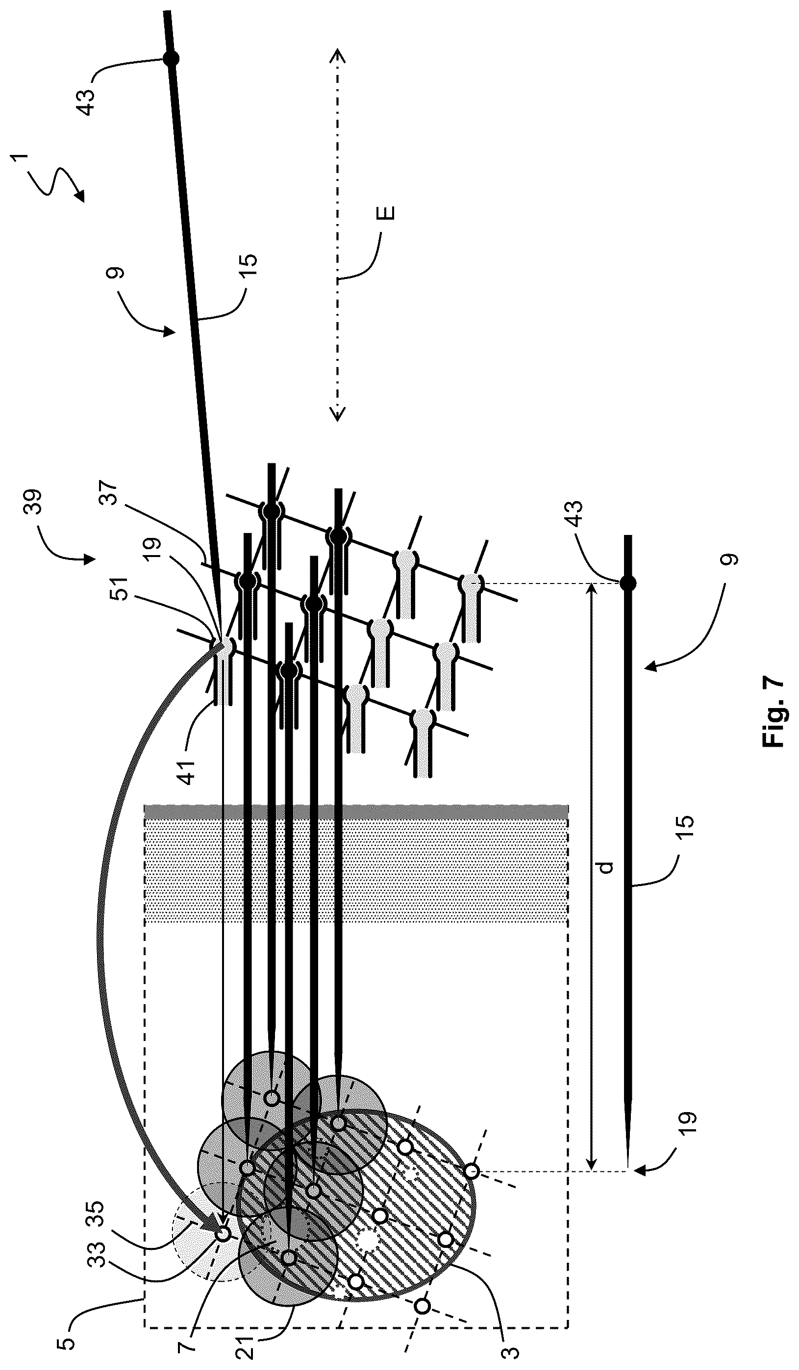 Patent US12576283 Figure 7 – System for performing transcutaneous photodynamic therapy (PDT) in an organ or organ segment of an organic body