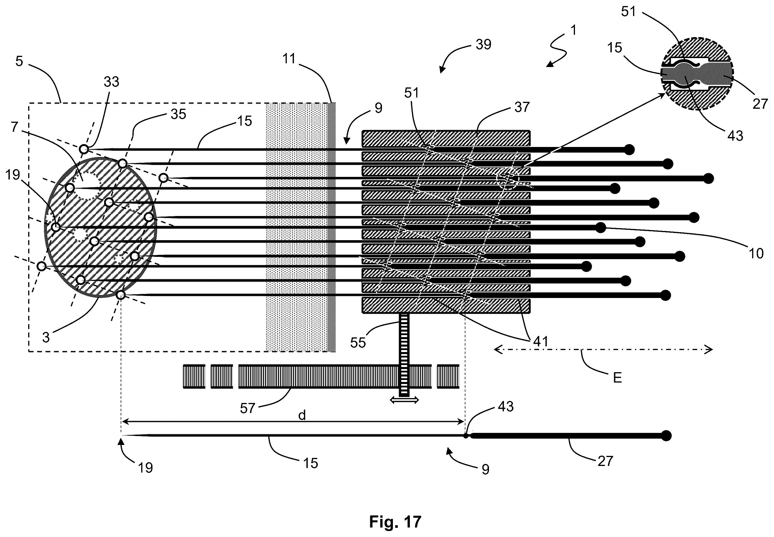 Patent US12576283 Figure 17 – System for performing transcutaneous photodynamic therapy (PDT) in an organ or organ segment of an organic body