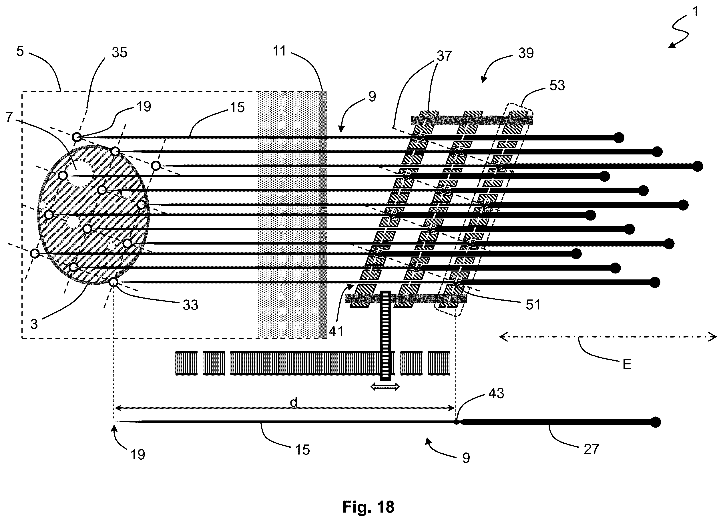 Patent US12576283 Figure 18 – System for performing transcutaneous photodynamic therapy (PDT) in an organ or organ segment of an organic body