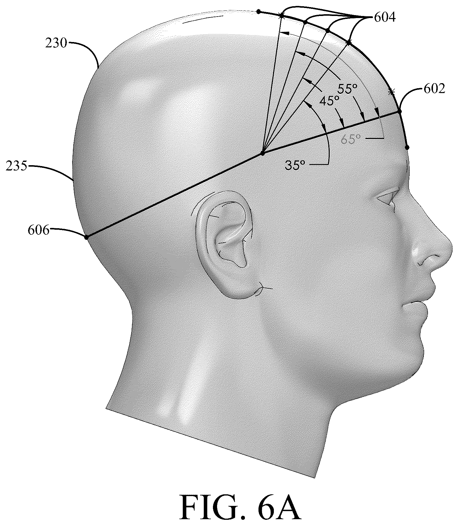 Patent US12576289 Figure 11 – Systems and methods for reliable replacement of ultrasound neuromodulation wearables