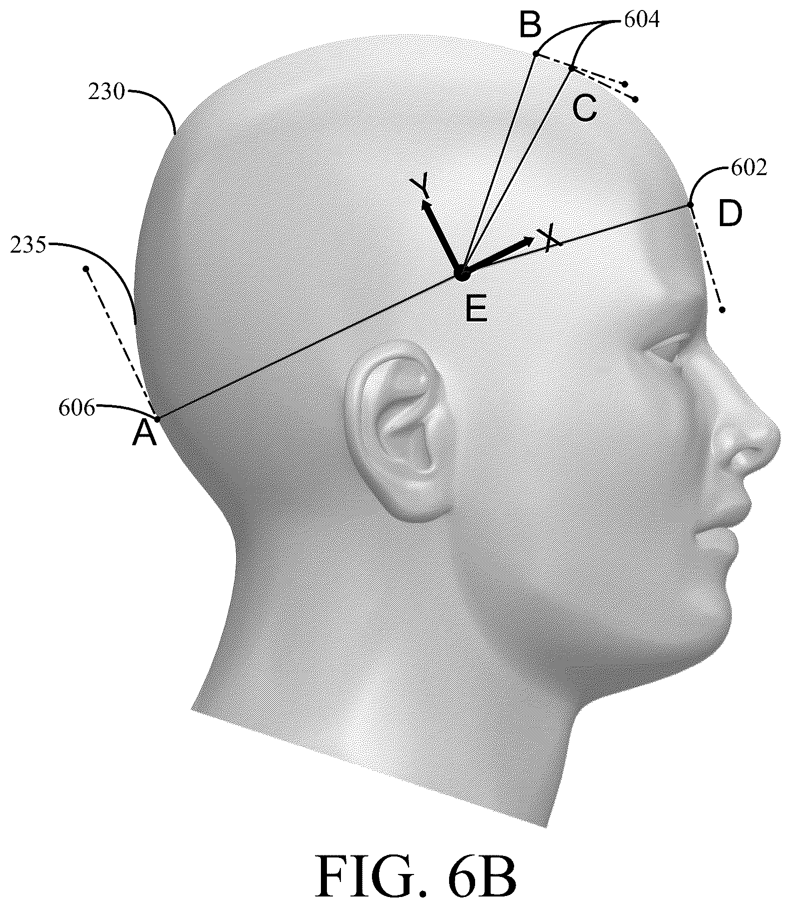 Patent US12576289 Figure 12 – Systems and methods for reliable replacement of ultrasound neuromodulation wearables