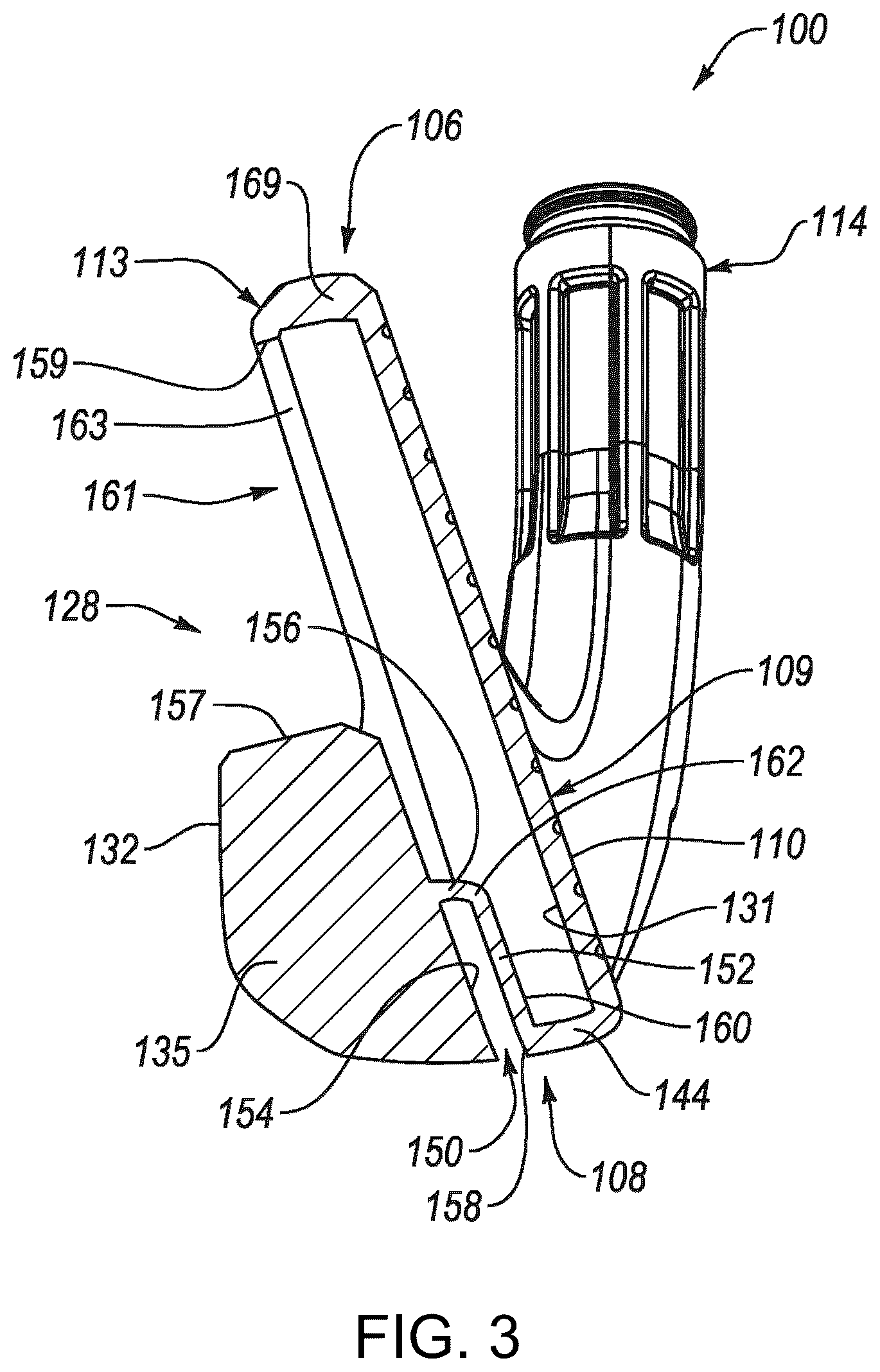 Patent US12576315 Figure 3 – Clubheads for iron-type golf clubs