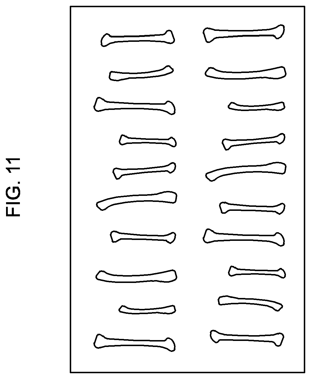 Patent US12576434 Figure 10 – Livestock carcass treatment system using ultra-high temperature microorganisms