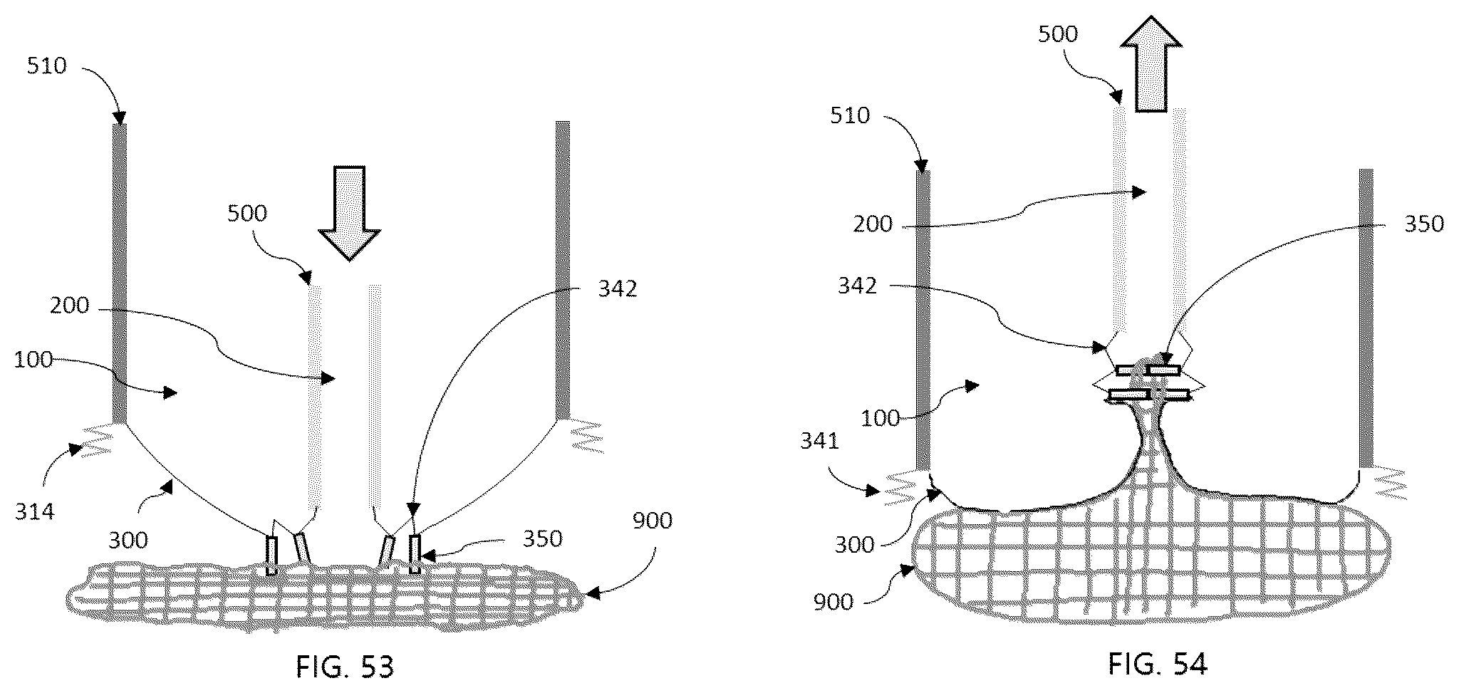 Patent US12576544 Figure 17 – Method and apparatus for an adaptable suction device