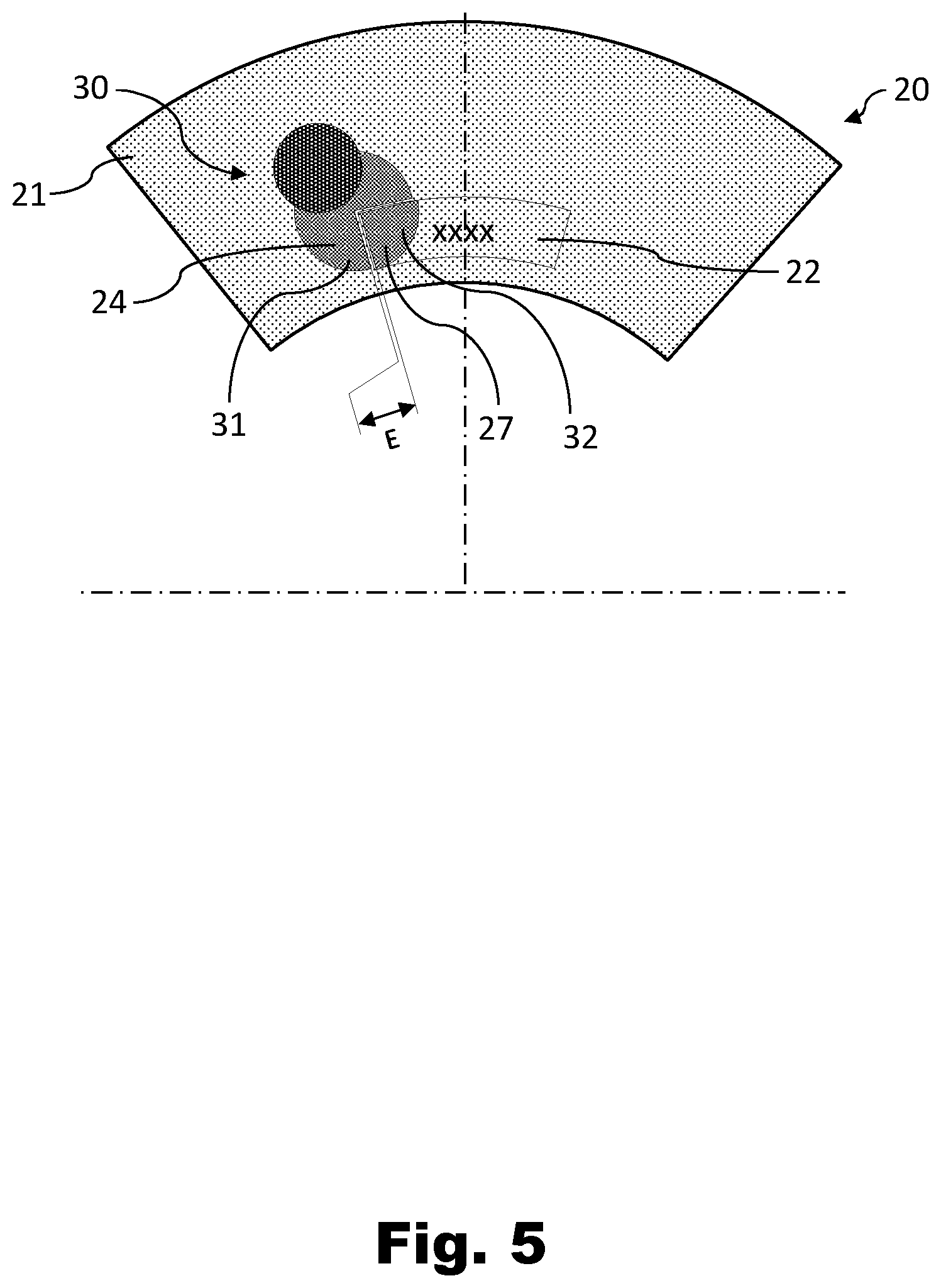 Patent US12576605 Figure 5 – Tire curing mold having a removable insert, and associated manufacturing method