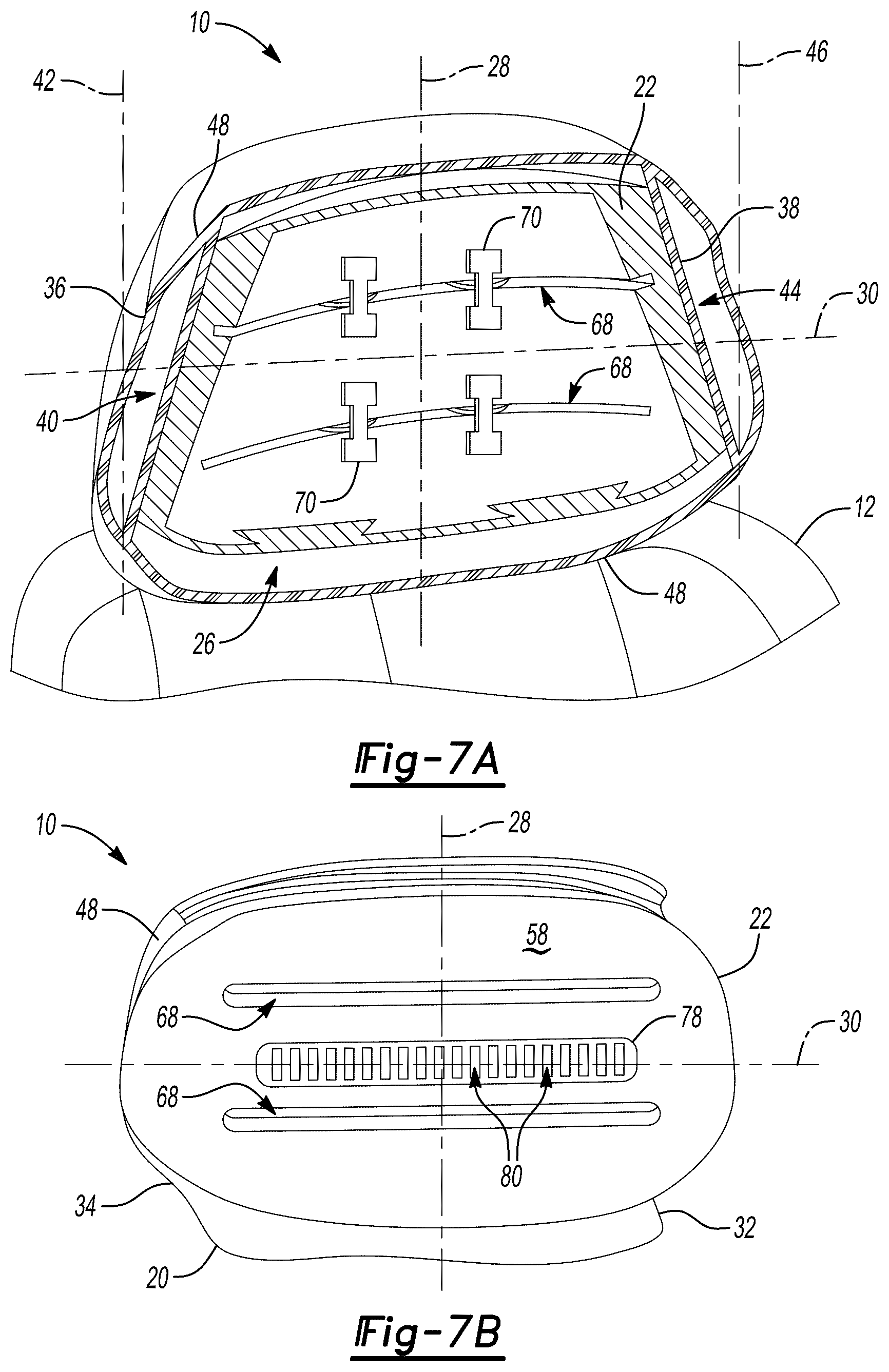 Patent US12576766 Figure 4 – Headrest, vehicle, and method of adjusting the headrest