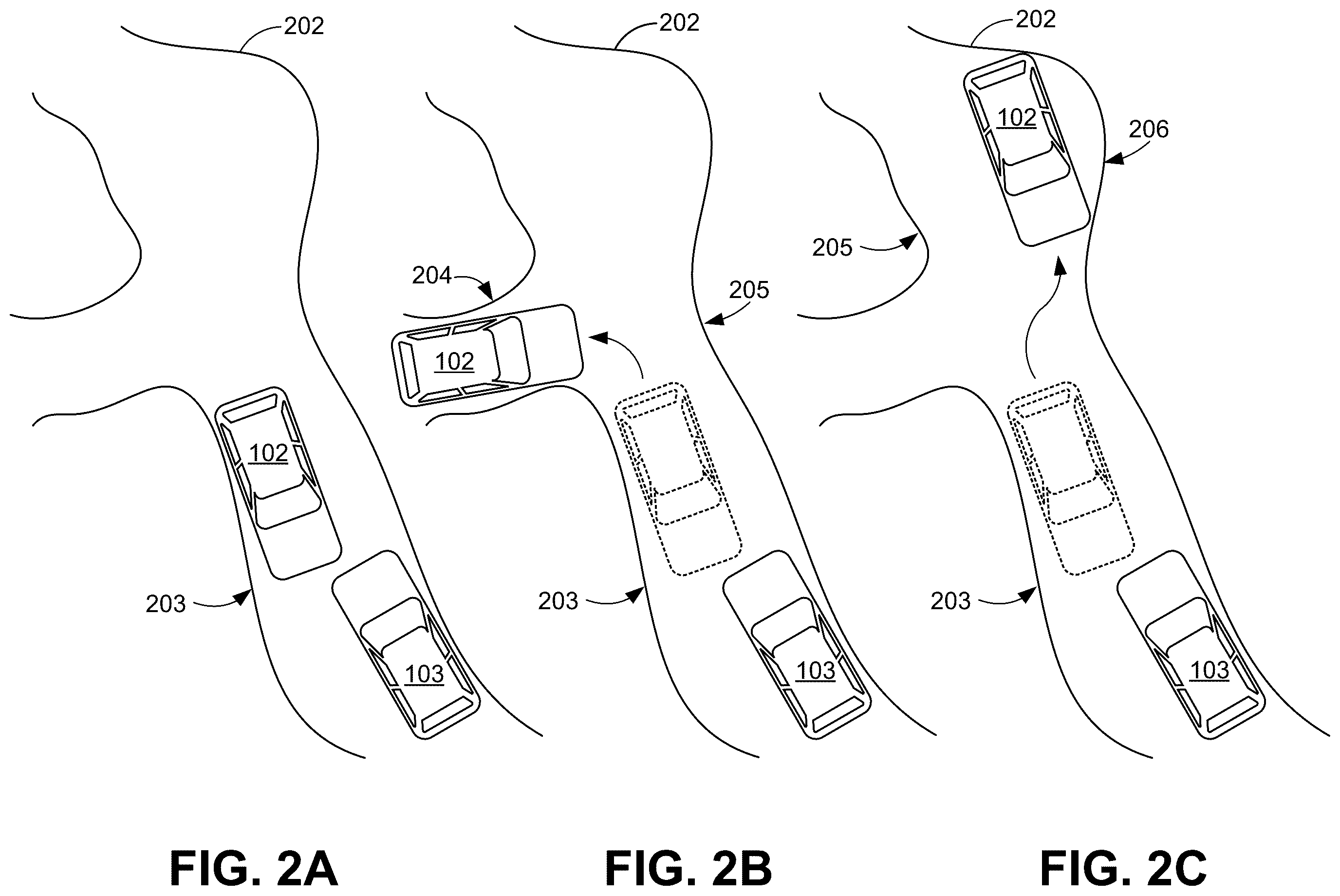 Patent US12576851 Figure 2 – Vehicle pass maneuvering