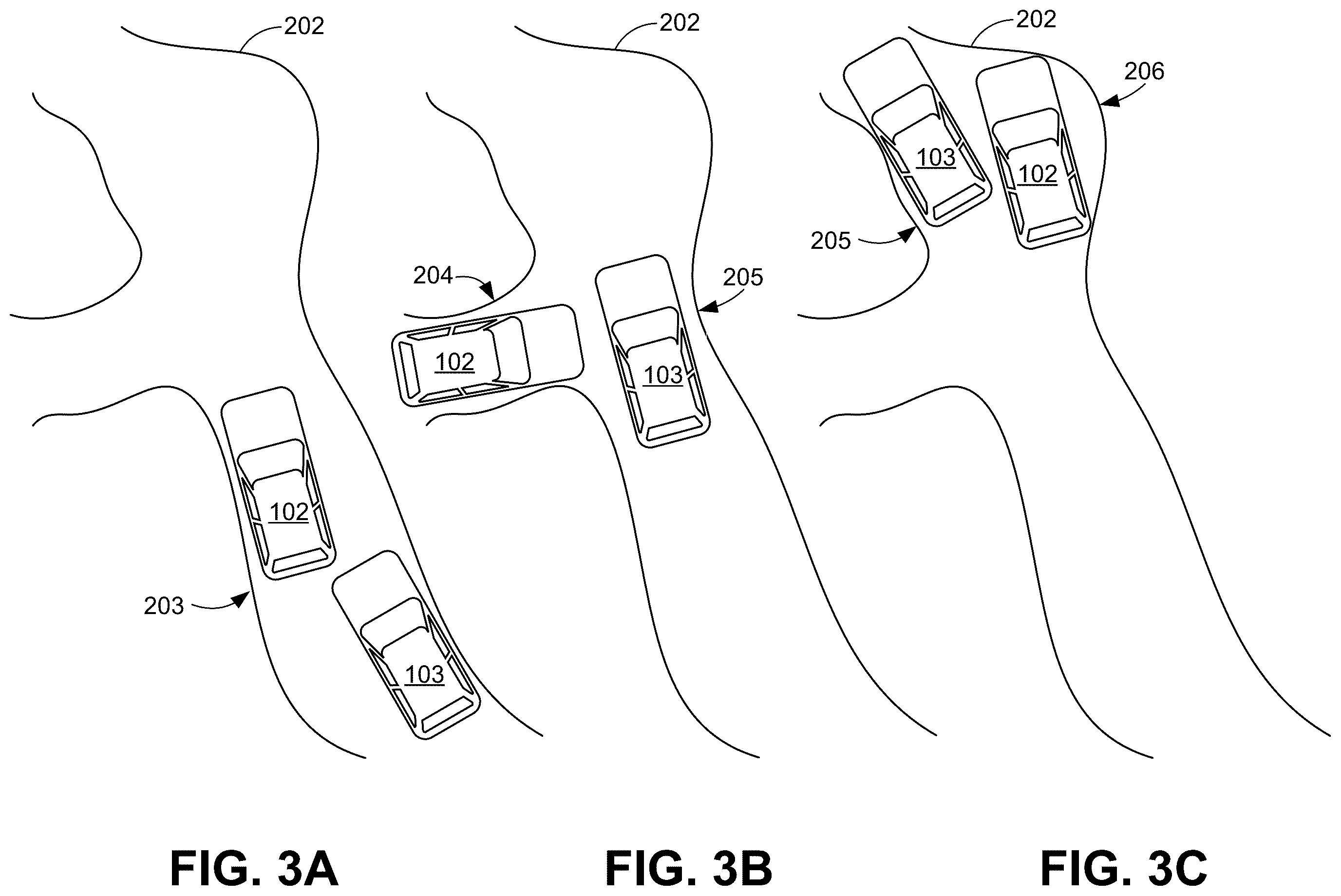 Patent US12576851 Figure 3 – Vehicle pass maneuvering