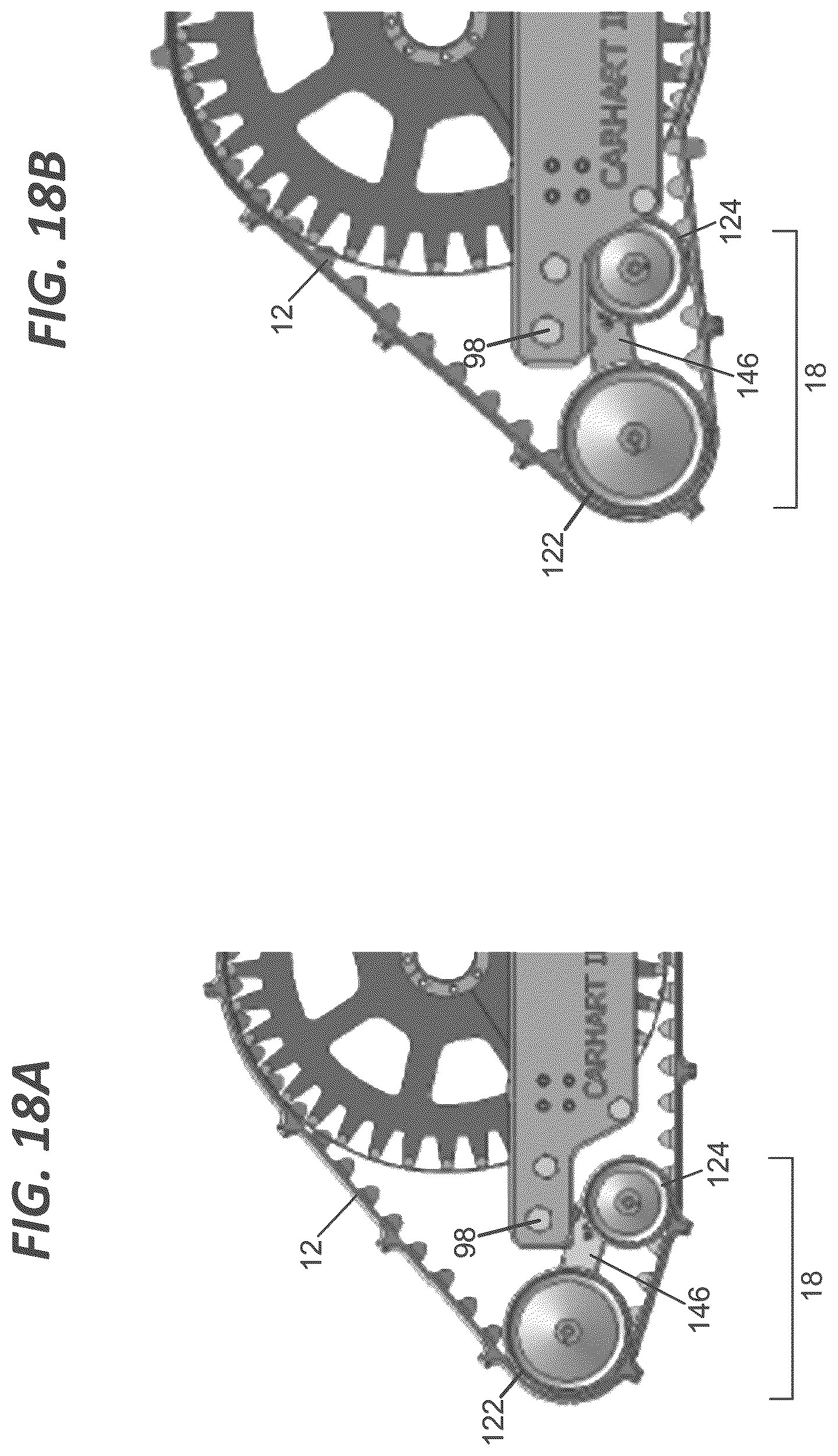 Patent US12576929 Figure 18 – Endless track assembly