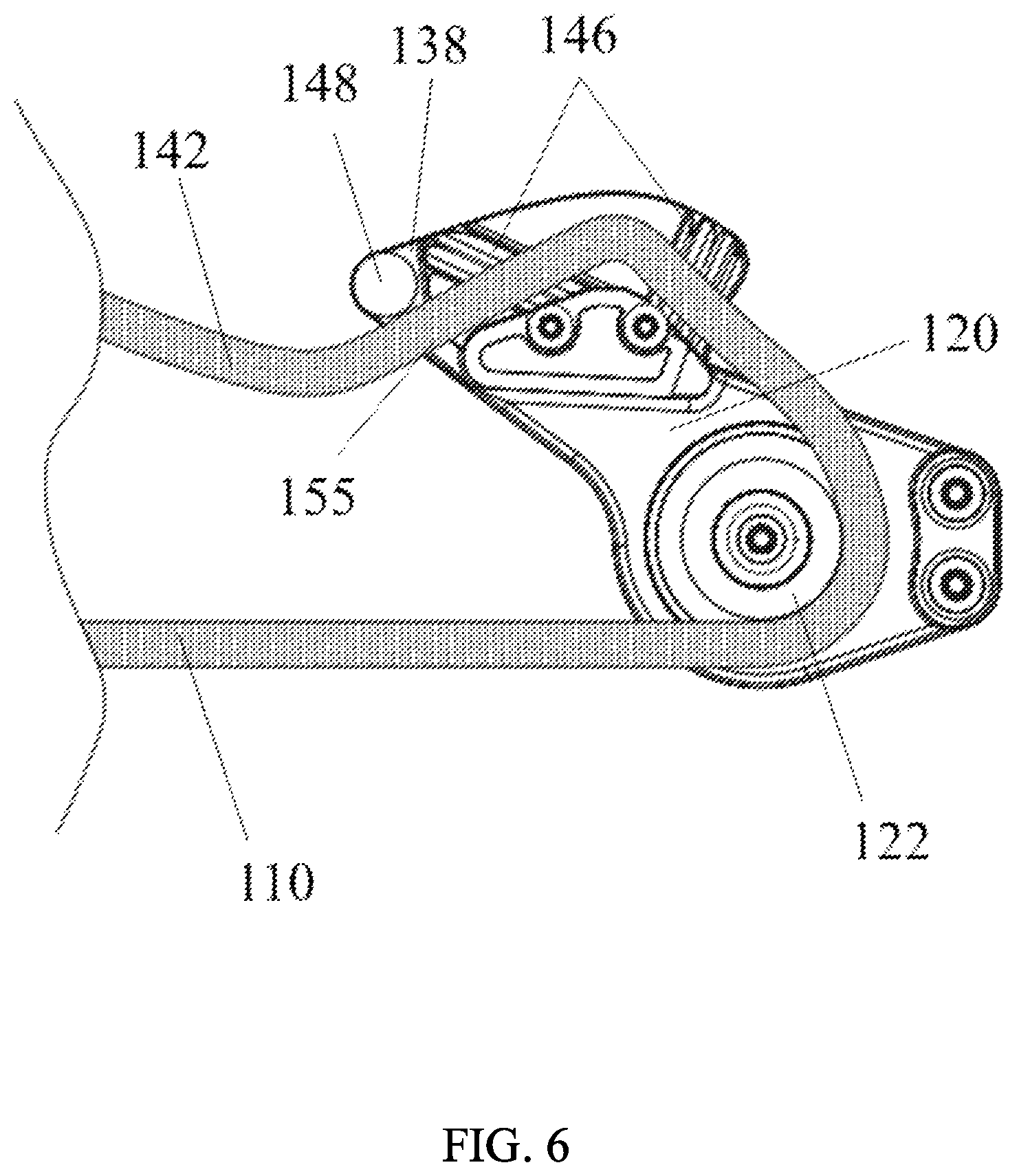 Patent US12576948 Figure 9 – Block and tackle assembly for bladder anchor