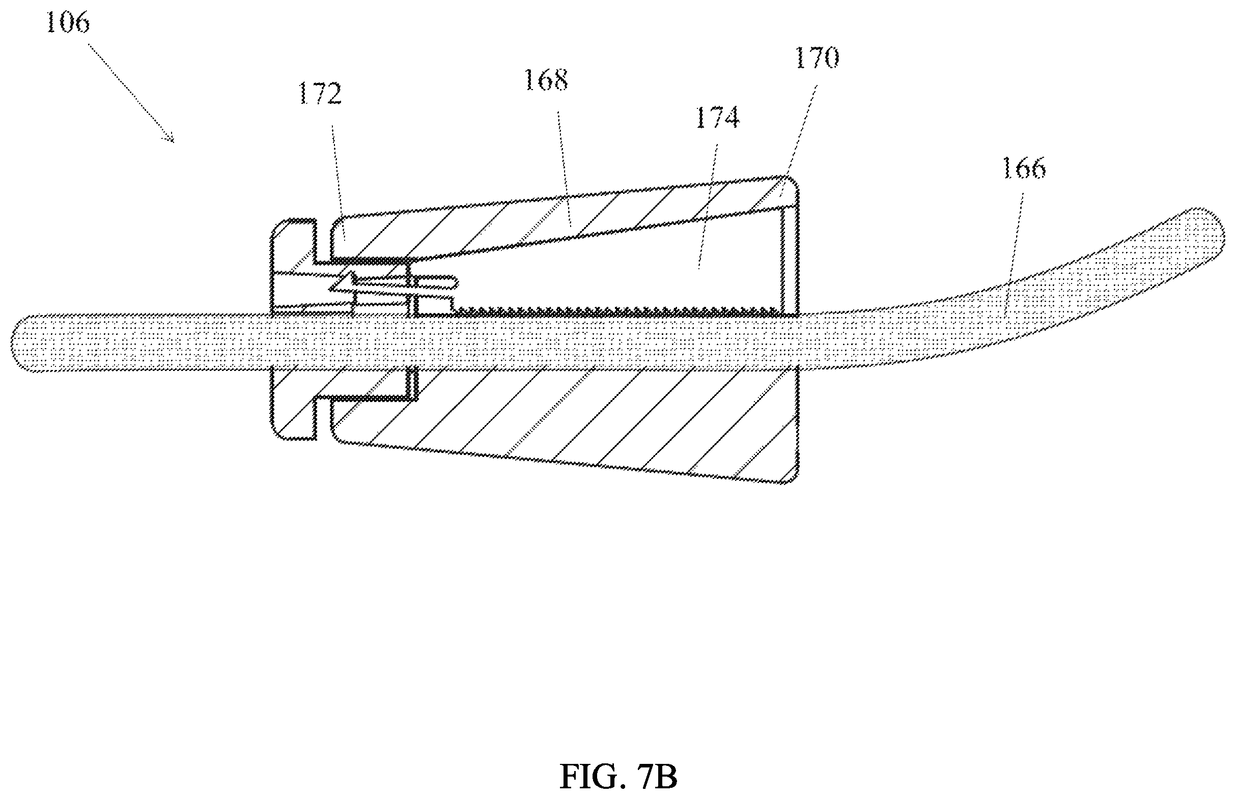 Patent US12576948 Figure 11 – Block and tackle assembly for bladder anchor