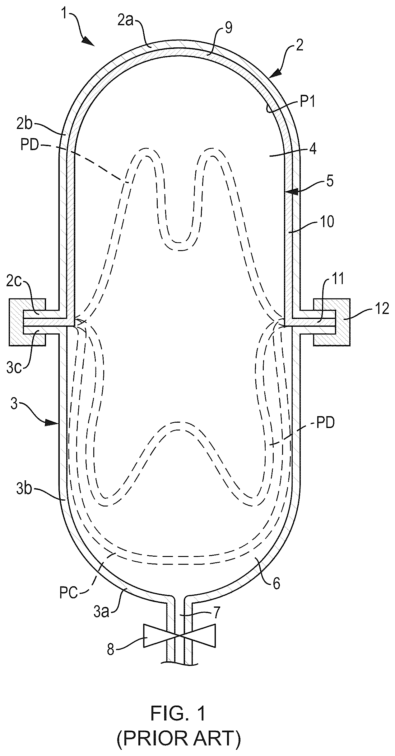 Patent US12576994 — Diaphragm for a fluid storage tank — Figure 1